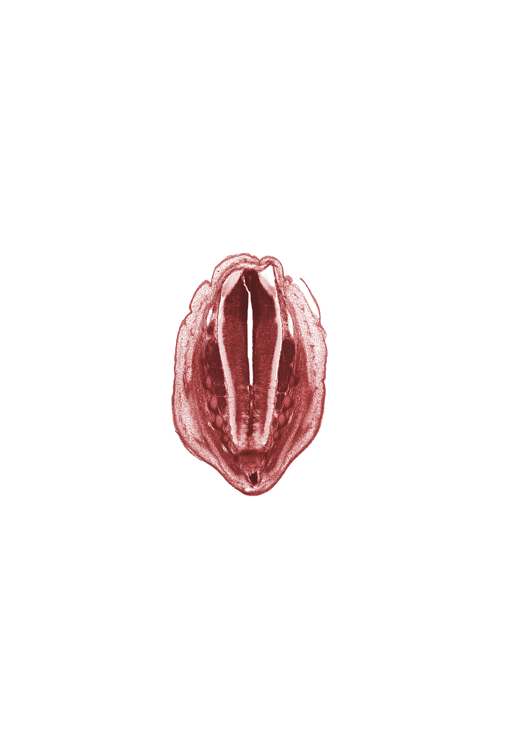 S-1 spinal ganglion, S-2 spinal ganglion, S-3 spinal ganglion, S-4 spinal ganglion, central canal, dorsal fasciculus, filum terminale, grey matter, junction of caudal end of coccyx and filum terminale, neural arch, neural arch of S-5 vertebra, surface ectoderm, white matter