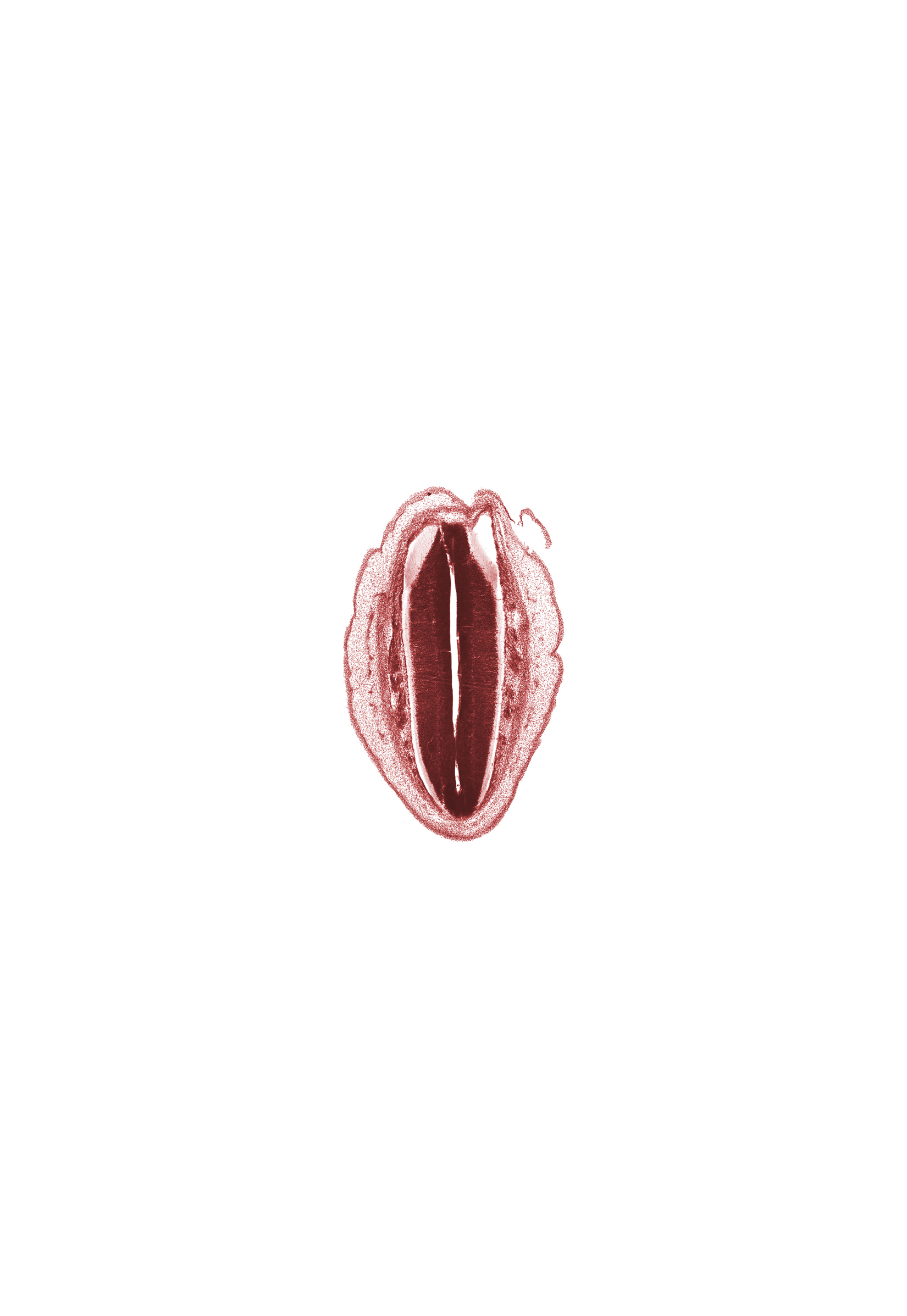 L-5 dorsal root, artifact space(s), central canal, intermediate zone, marginal zone, osteogenic layer, ventricular zone