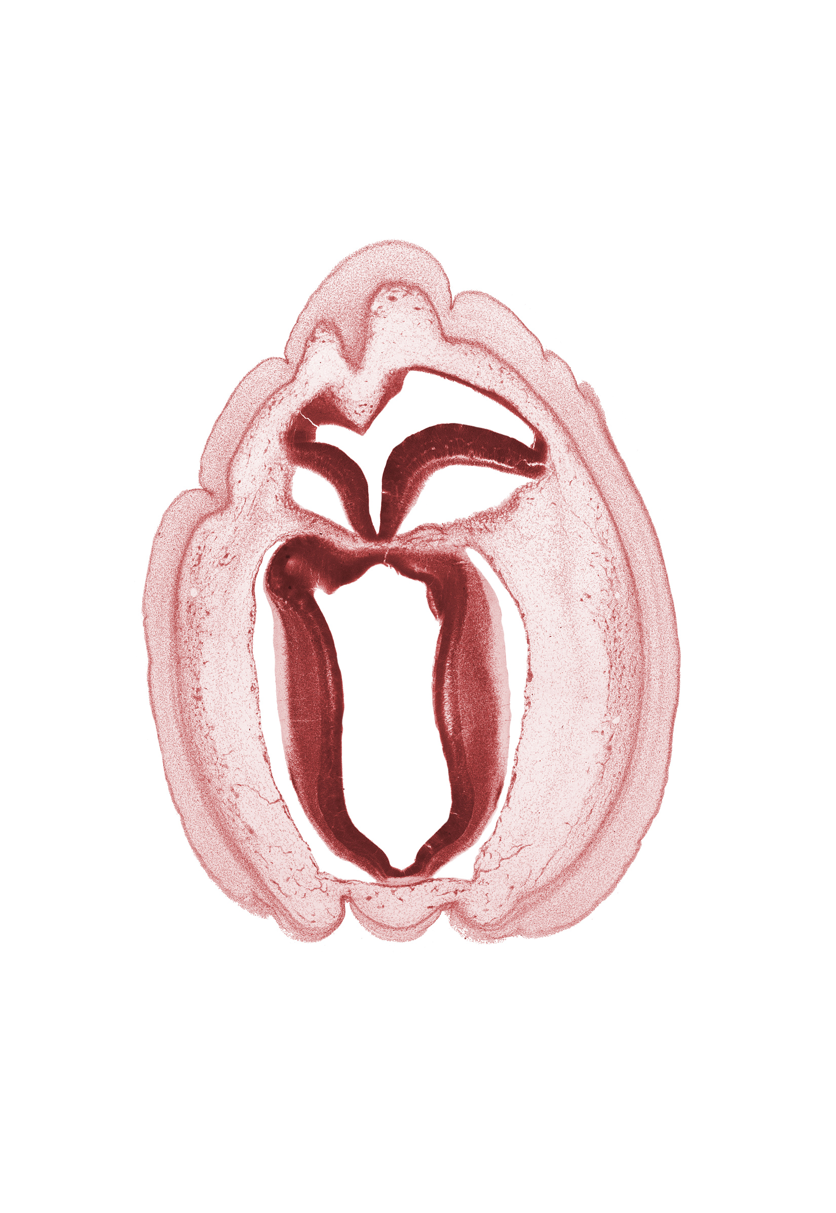 alar plate of mesencephalon, alar plate of metencephalon, fiber tract, intermediate zone, marginal zone, rhombencoel (fourth ventricle), roof plate, roof plate of metencephalon, root of trochlear nerve (CN IV), ventricular zone