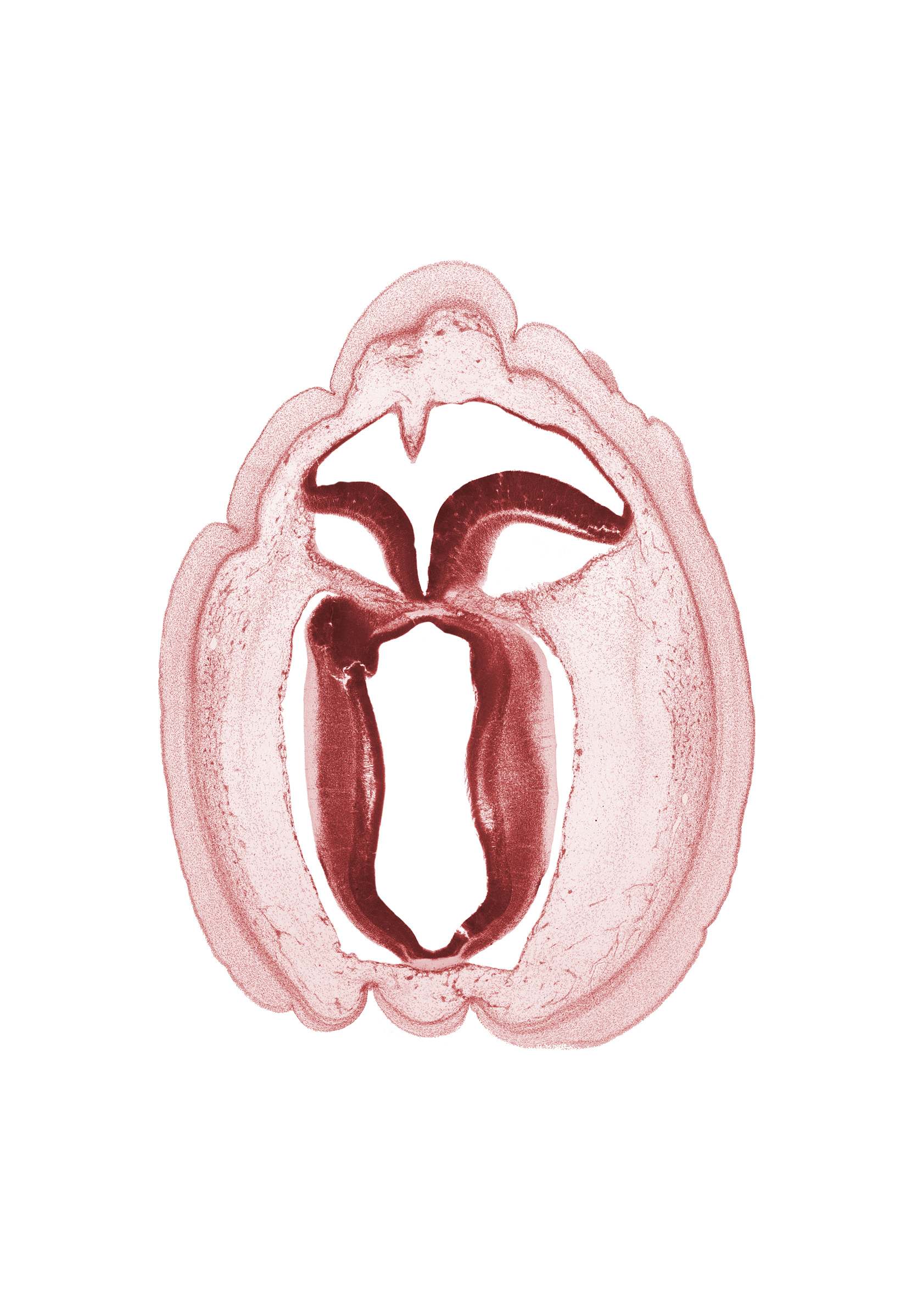 artifact space(s), cerebral aqueduct (longitudinal section), commissure in roof plate of mesencephalon, fiber tract, head mesenchyme, osteogenic layer, rhombencoel (fourth ventricle), subarachnoid space, surface ectoderm, trochlear nerve (CN IV)