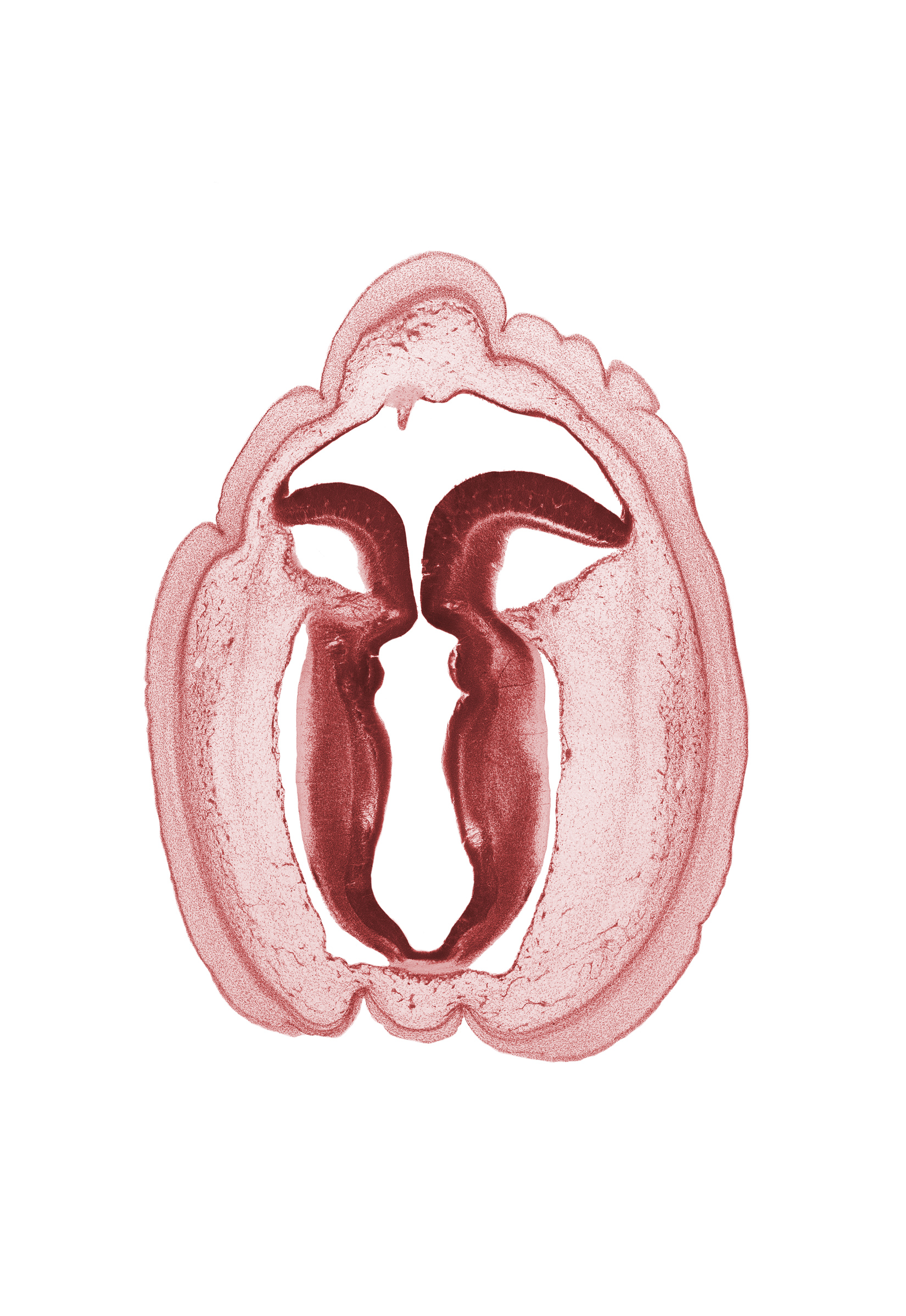 alar plate(s), artifact space(s), basal plate, commissure in roof plate of mesencephalon, fiber tract, intermediate zone, isthmus of rhombencephalon, marginal zone, rhombencoel (fourth ventricle), roof of rhombencoel (fourth ventricle), sulcus limitans, ventricular zone