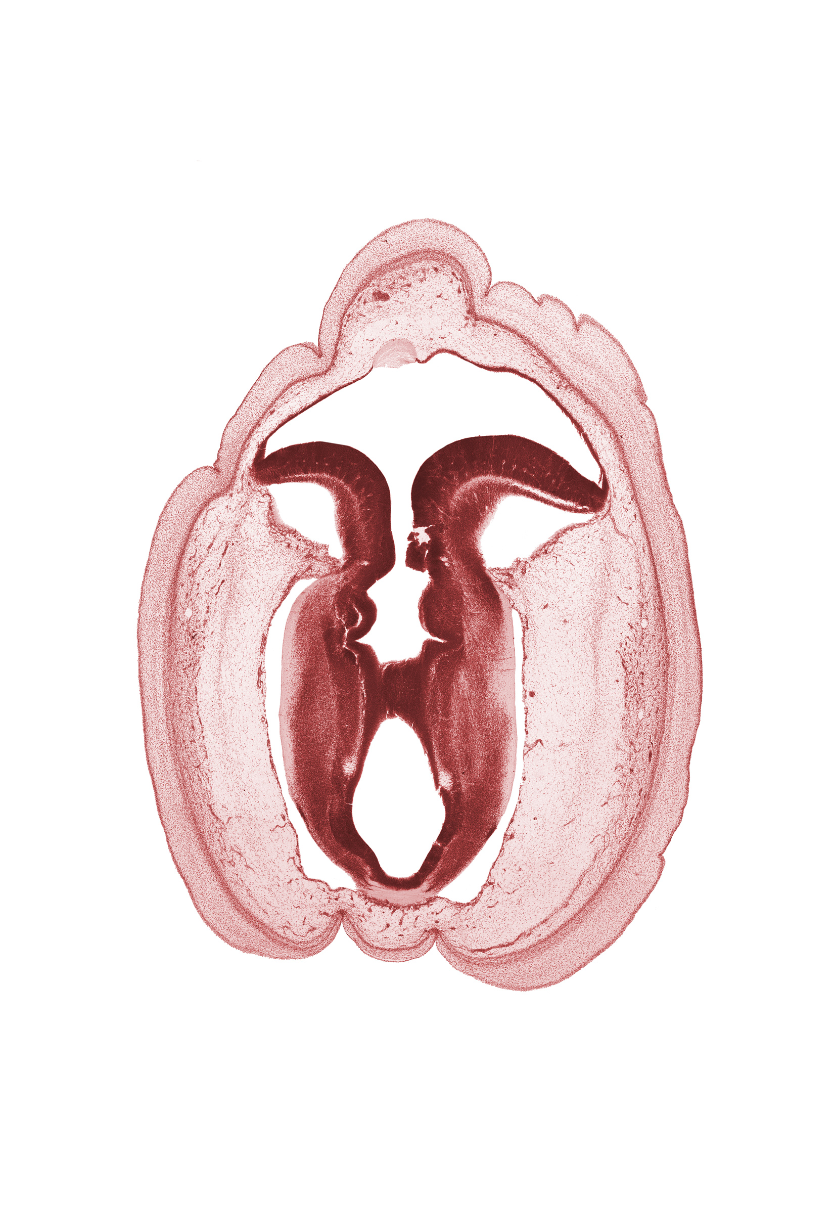 alar plate of metencephalon (cerebellum), artifact fracture(s), commissure in roof plate of mesencephalon, intermediate zone, isthmus of rhombencephalon, marginal zone, osteogenic layer, rhombencoel (fourth ventricle), subarachnoid space, trochlear nerve (CN IV), ventricular zone