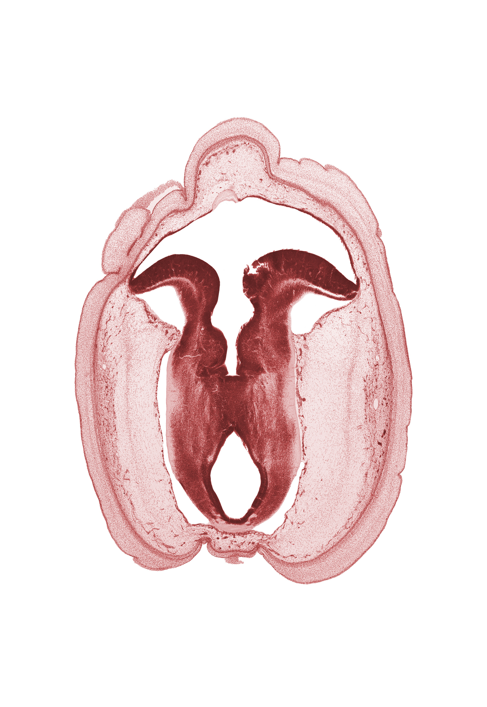 alar plate of mesencephalon, alar plate of metencephalon (cerebellum), basal plate of mesencephalon, basal plate of metencephalon, cerebral aqueduct (mesocoele), commissure in roof plate of mesencephalon, fiber tract, floor plate, isthmus of rhombencephalon, osteogenic layer, rhombencoel (fourth ventricle), subarachnoid space, sulcus limitans, trochlear nerve (CN IV), vascular plexus