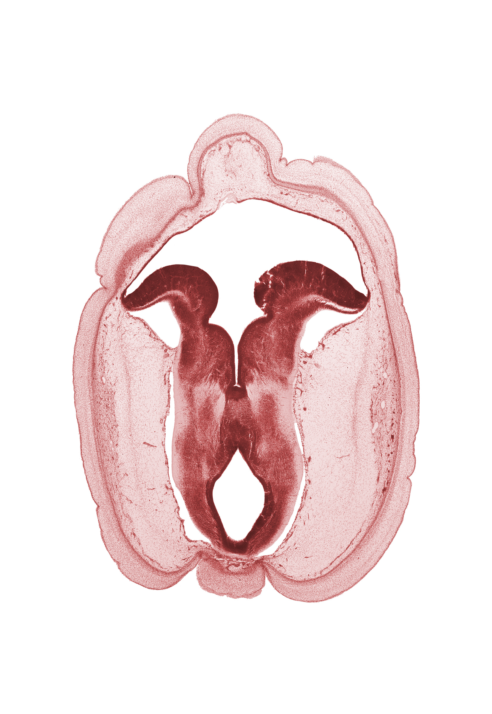 artifact space(s), cerebral aqueduct (mesocoele), head mesenchyme, mesencephalon, osteogenic layer, rhombencoel (fourth ventricle), subarachnoid space, surface ectoderm, tectum of mesencephalon, trochlear nerve (CN IV), vascular plexus