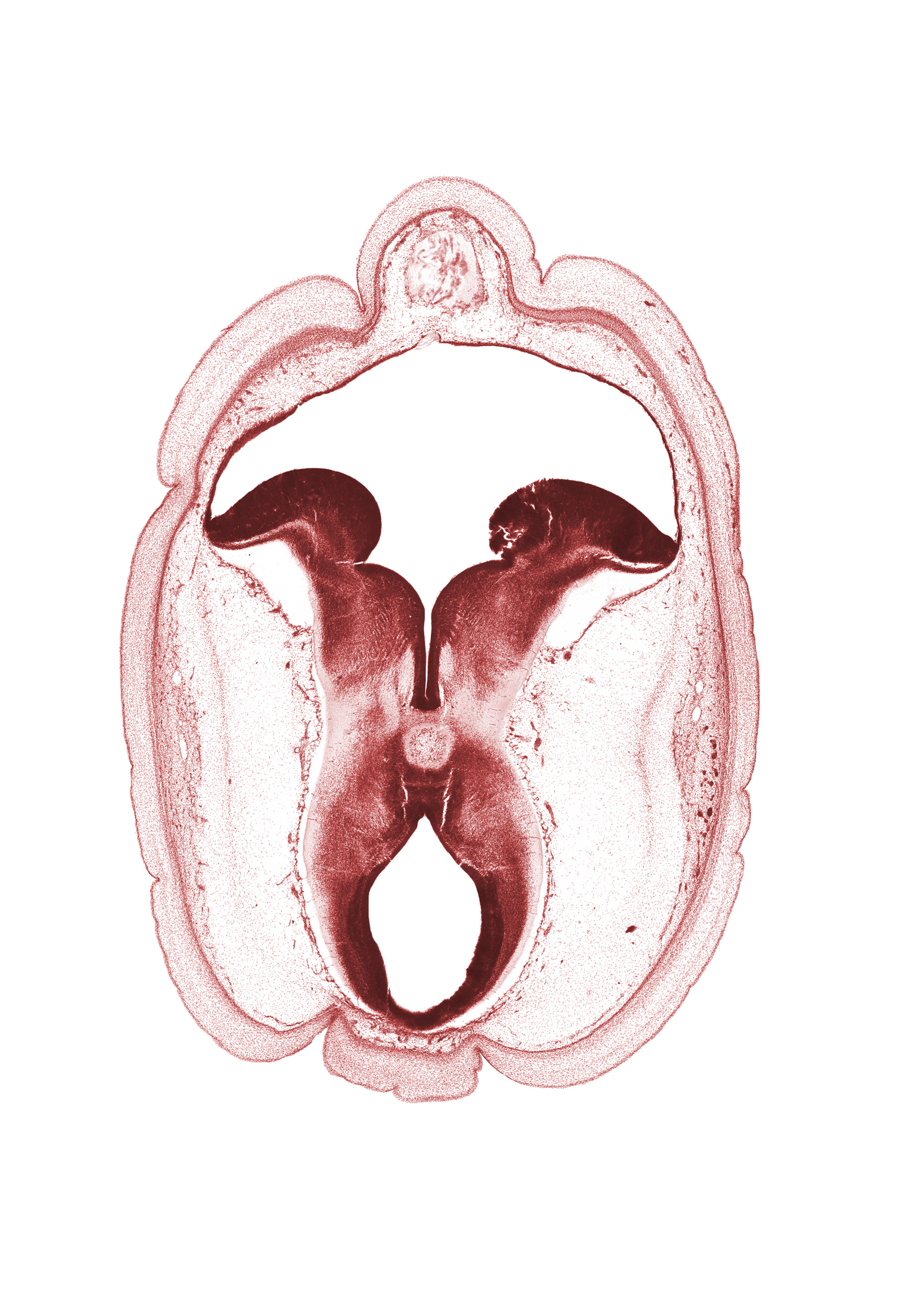 cerebral aqueduct (mesocoele), cerebral peduncle, diverticulum of rhombencoel (fourth ventricle), interpeduncular fossa, mesencephalon, metencephalon, osteogenic layer, rhombencoel (fourth ventricle), roof plate, subarachnoid space, sulcus limitans, tectum of mesencephalon, tegmentum of mesencephalon, tegmentum of metencephalon, trochlear nerve (CN IV)