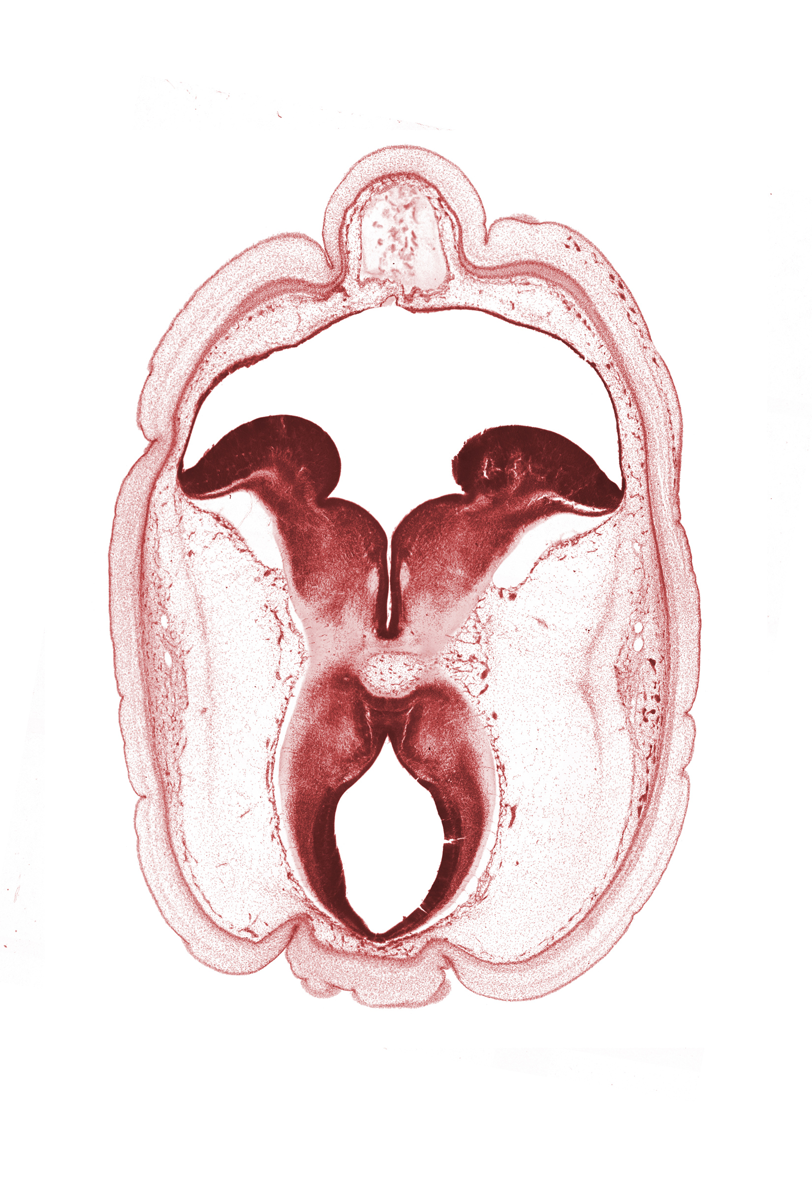 artifact space(s), cerebral aqueduct (mesocoele), cerebral peduncle, diverticulum of rhombencoel (fourth ventricle), floor plate, head mesenchyme, interpeduncular fossa, rhombencoel (fourth ventricle), roof plate, subarachnoid space, sulcus limitans, surface ectoderm, trochlear nerve (CN IV)