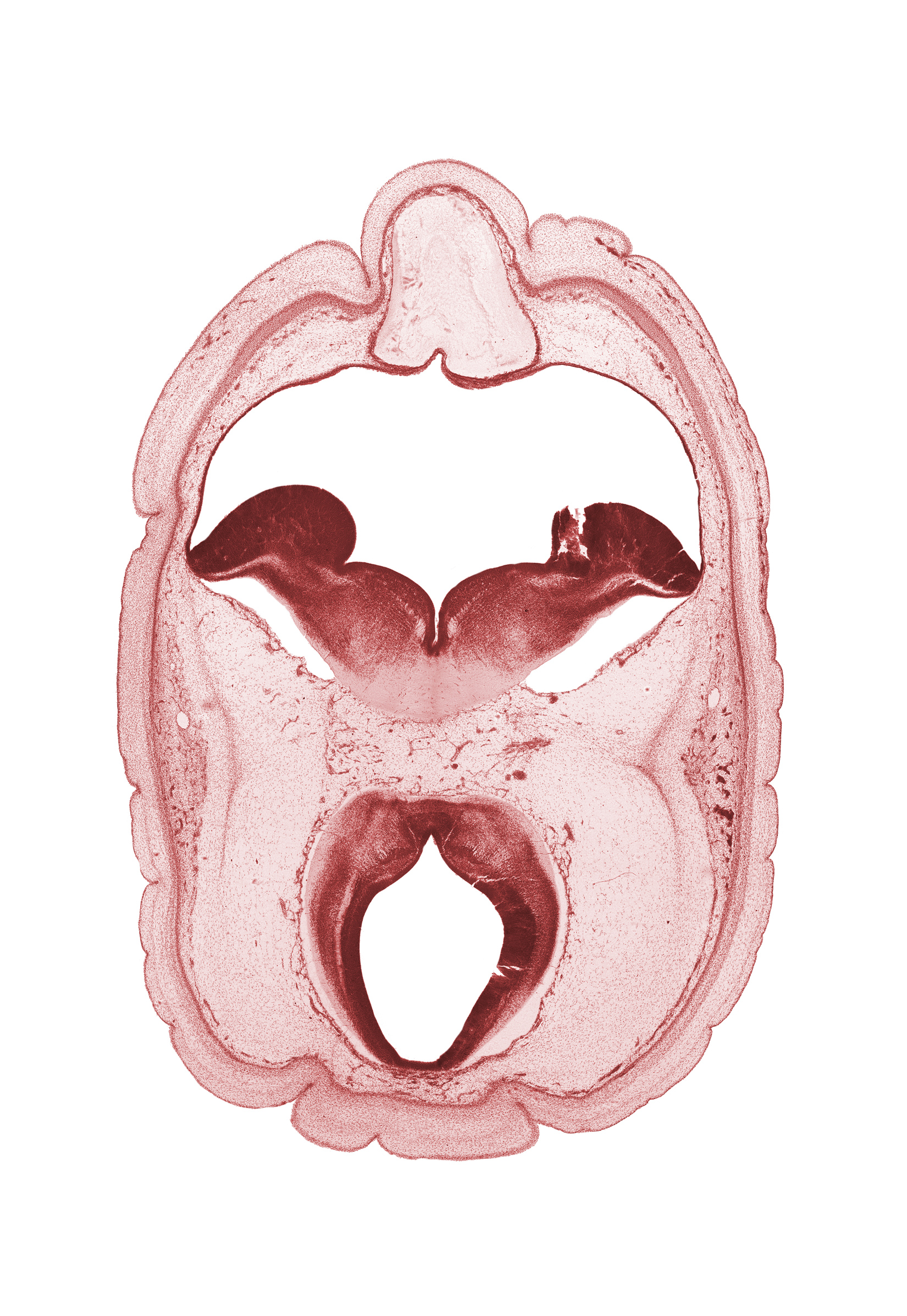 artifact fracture(s), cerebral aqueduct (mesocoele), diverticulum of rhombencoel (fourth ventricle), median sulcus, oculomotor nerve (CN III), osteogenic layer, roof plate of mesencephalon, roof plate of metencephalon, sulcus limitans, superficial vascular plexus, surface ectoderm, trochlear nerve (CN IV), vascular plexus