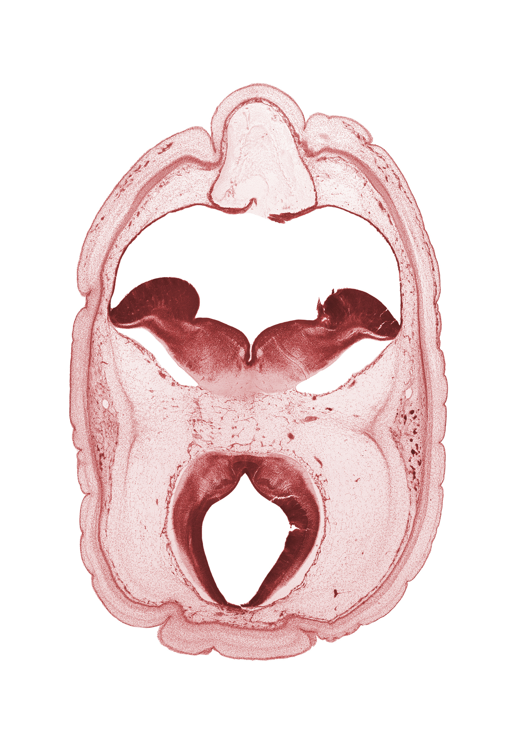 alar plate(s), basal plate, edge of choroid plexus, floor plate, head mesenchyme, oculomotor nerve (CN III), osteogenic layer, posterior cerebral artery, rhombencoel (fourth ventricle), roof plate, subarachnoid space, sulcus limitans, trochlear nerve (CN IV)