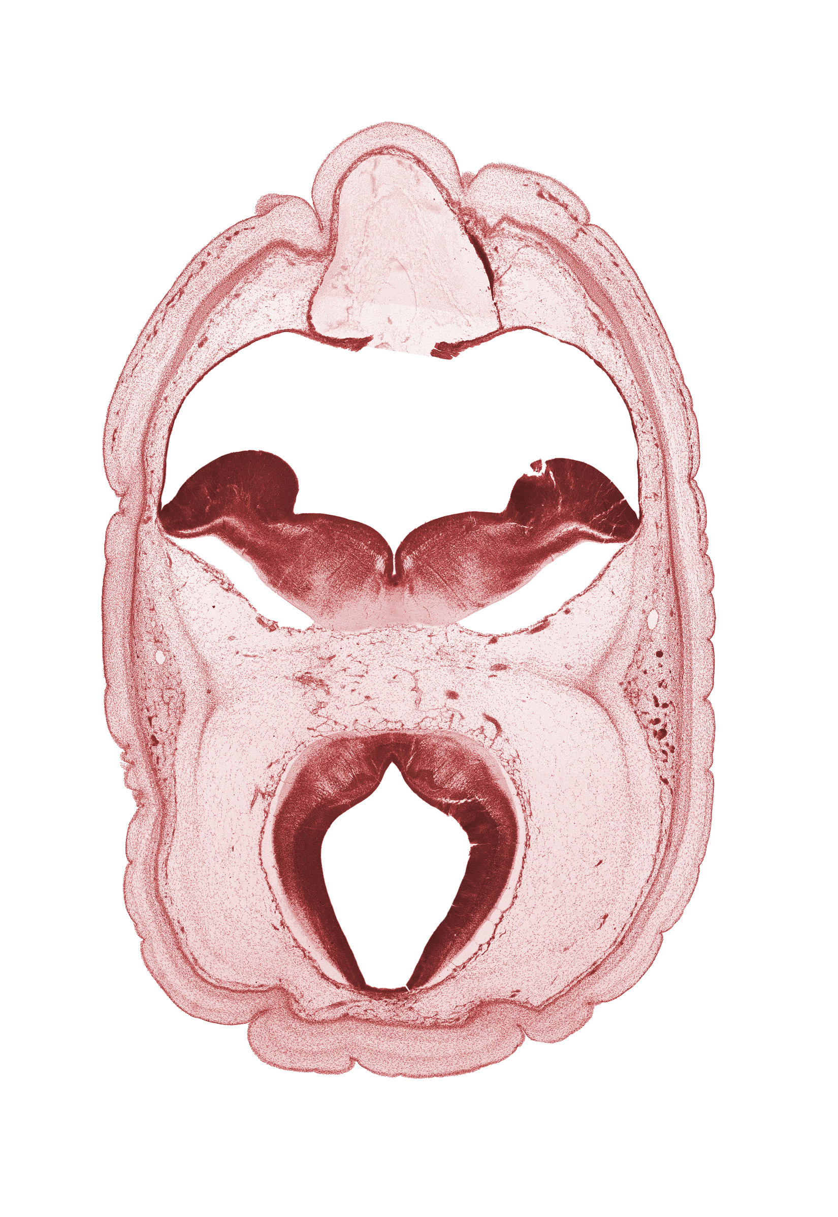 alar plate(s), artifact space(s), basal plate, dural band for tentorium cerebelli, floor plate of mesencephalon, oculomotor nerve (CN III), roof plate of mesencephalon, subarachnoid space, sulcus limitans, superficial vascular plexus, tectum of mesencephalon, tegmentum of mesencephalon, trochlear nerve (CN IV)