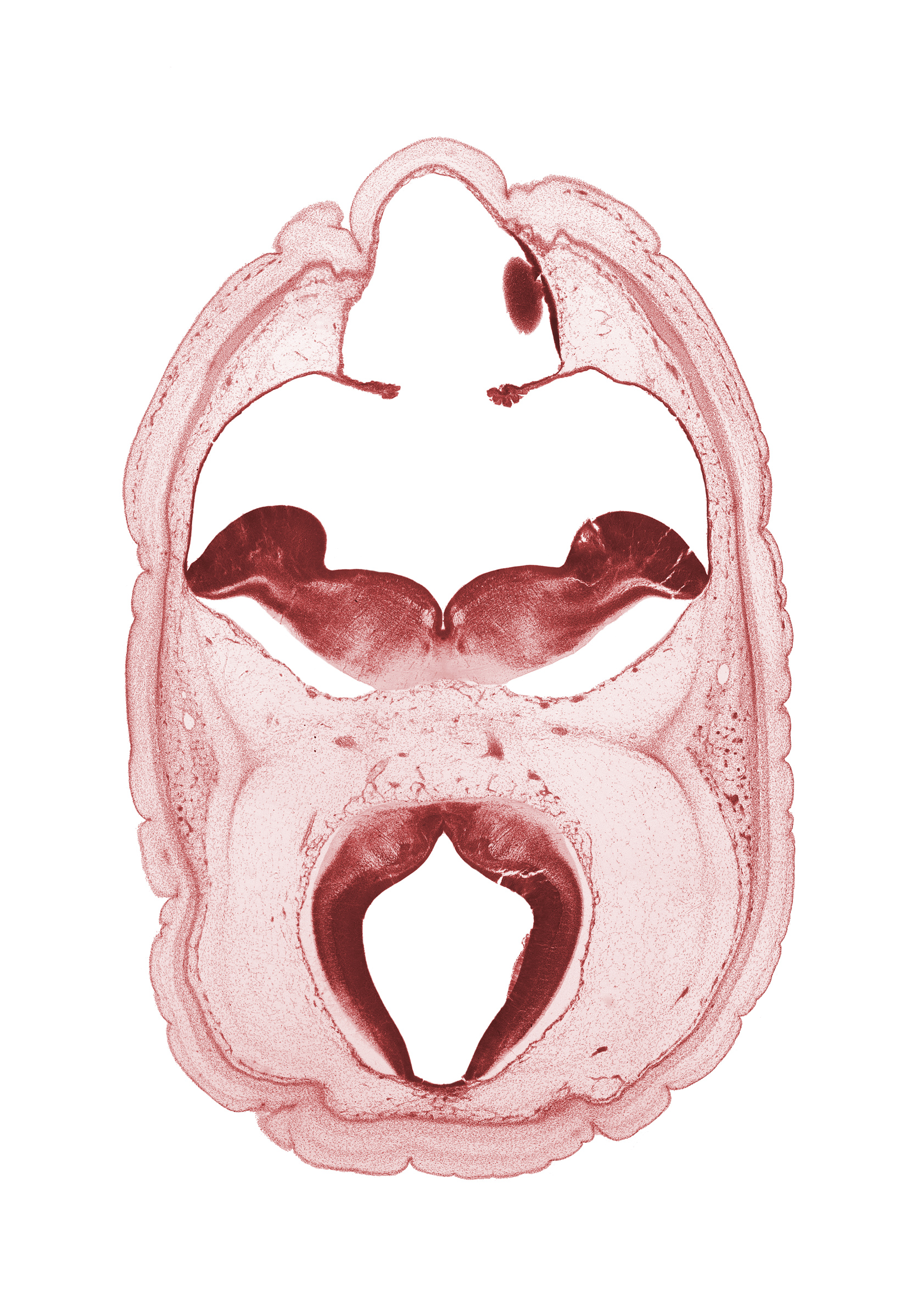 artifact space(s), cerebral aqueduct (mesocoele), choroid plexus, diverticulum of rhombencoel (fourth ventricle), edge of myelencephalon, middle dural venous plexus, pons region (metencephalon), posterior cerebral artery, rhombencoel (fourth ventricle), sulcus limitans, trochlear nerve (CN IV), venous plexus(es)