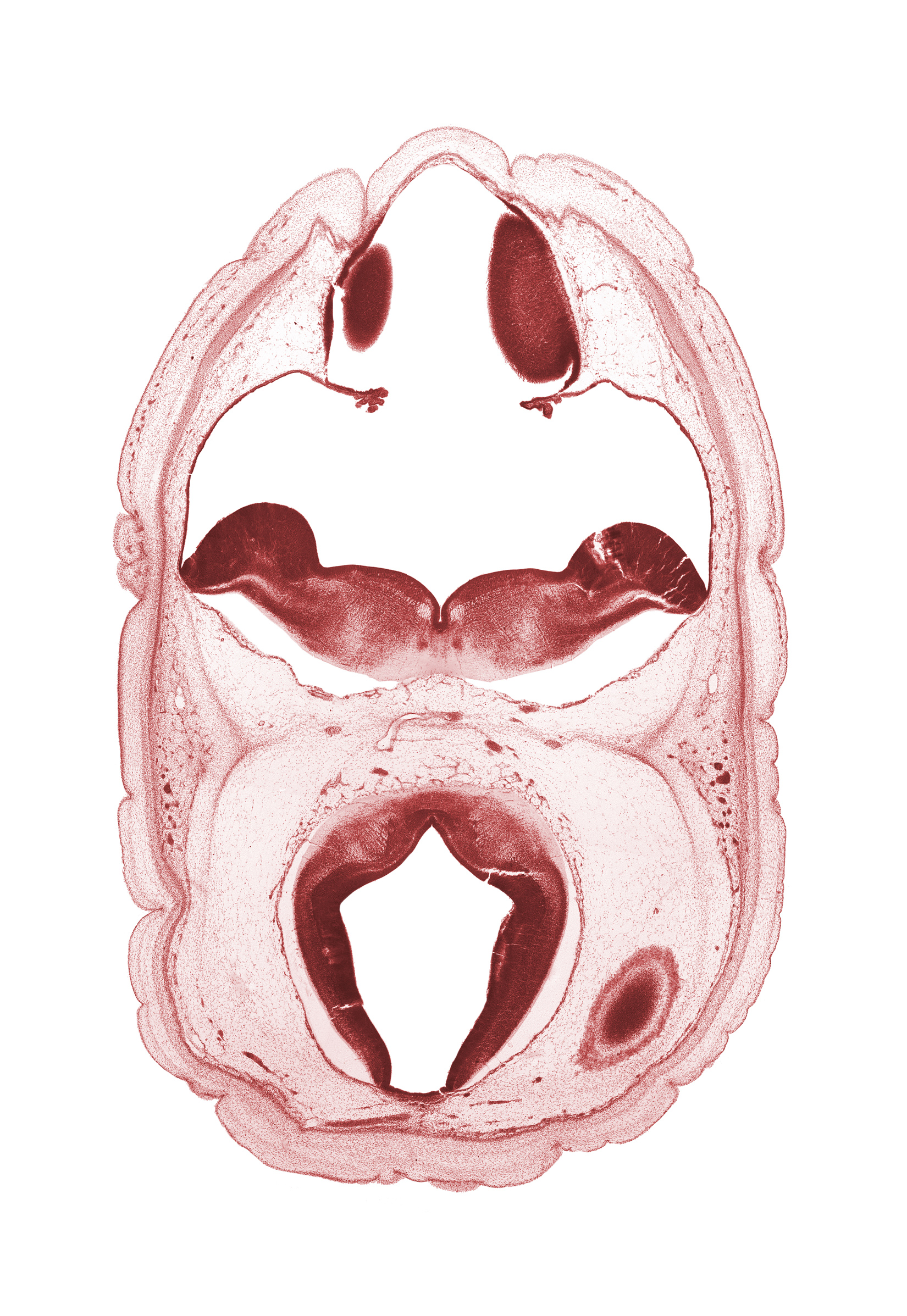 alar plate of myelencephalon, artifact space(s), cerebral aqueduct (mesocoele), cerebral vesicle (hemisphere), choroid plexus, dural band for tentorium cerebelli, median sulcus, posterior cerebral artery, rhombencoel (fourth ventricle), roof plate, roof plate of mesencephalon, sulcus limitans, tectum of mesencephalon, tegmentum of mesencephalon, trochlear nerve (CN IV)