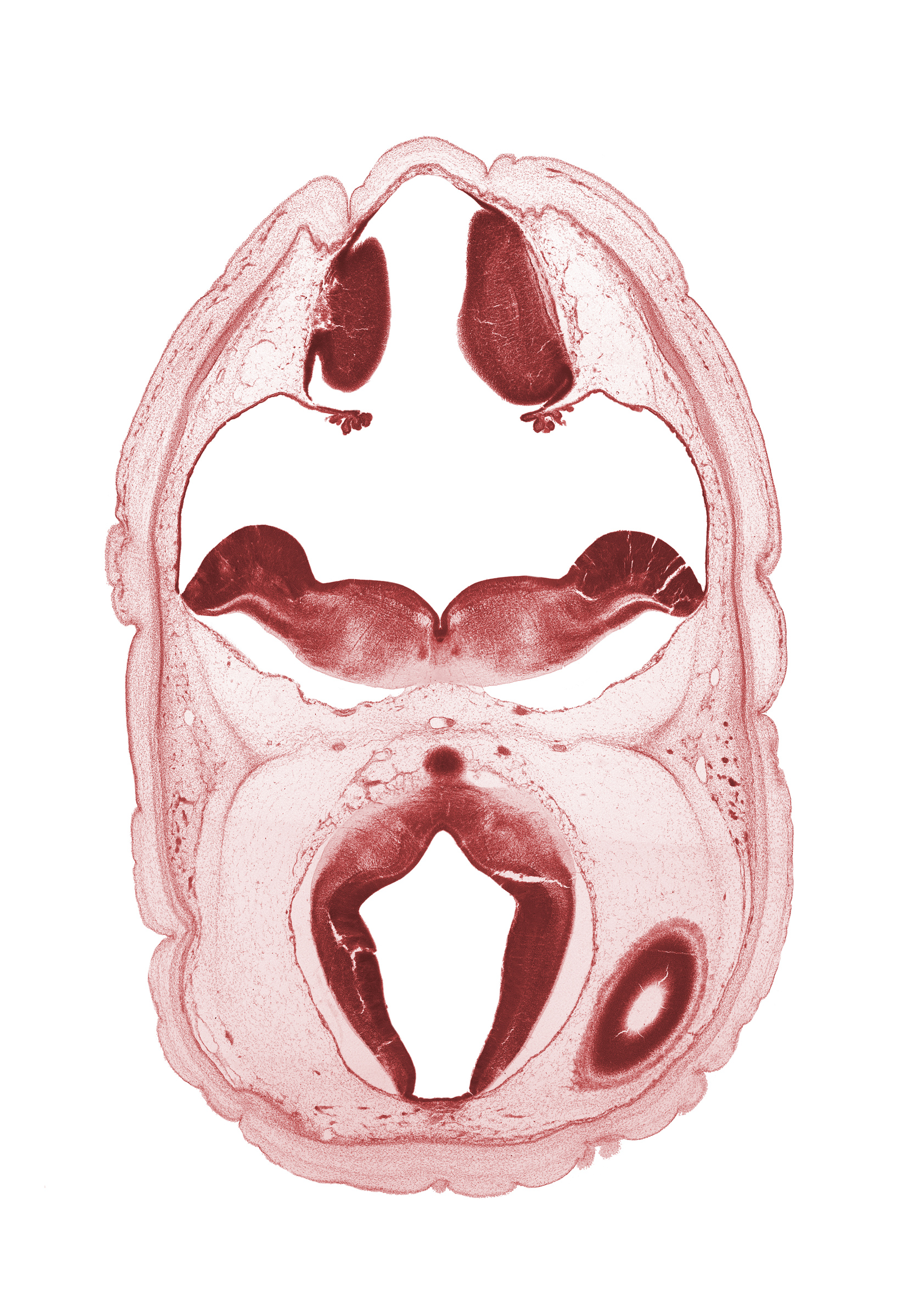 alar plate of metencephalon (cerebellum), artifact space(s), basal plate of caudal part of diencephalon, basal plate of metencephalon, caudal edge of diencephalon, cerebral aqueduct (mesocoele), edge of lateral ventricle, myelencephalon, osteogenic layer, rhombencoel (fourth ventricle), roof plate of mesencephalon, subarachnoid space, trochlear nerve (CN IV)