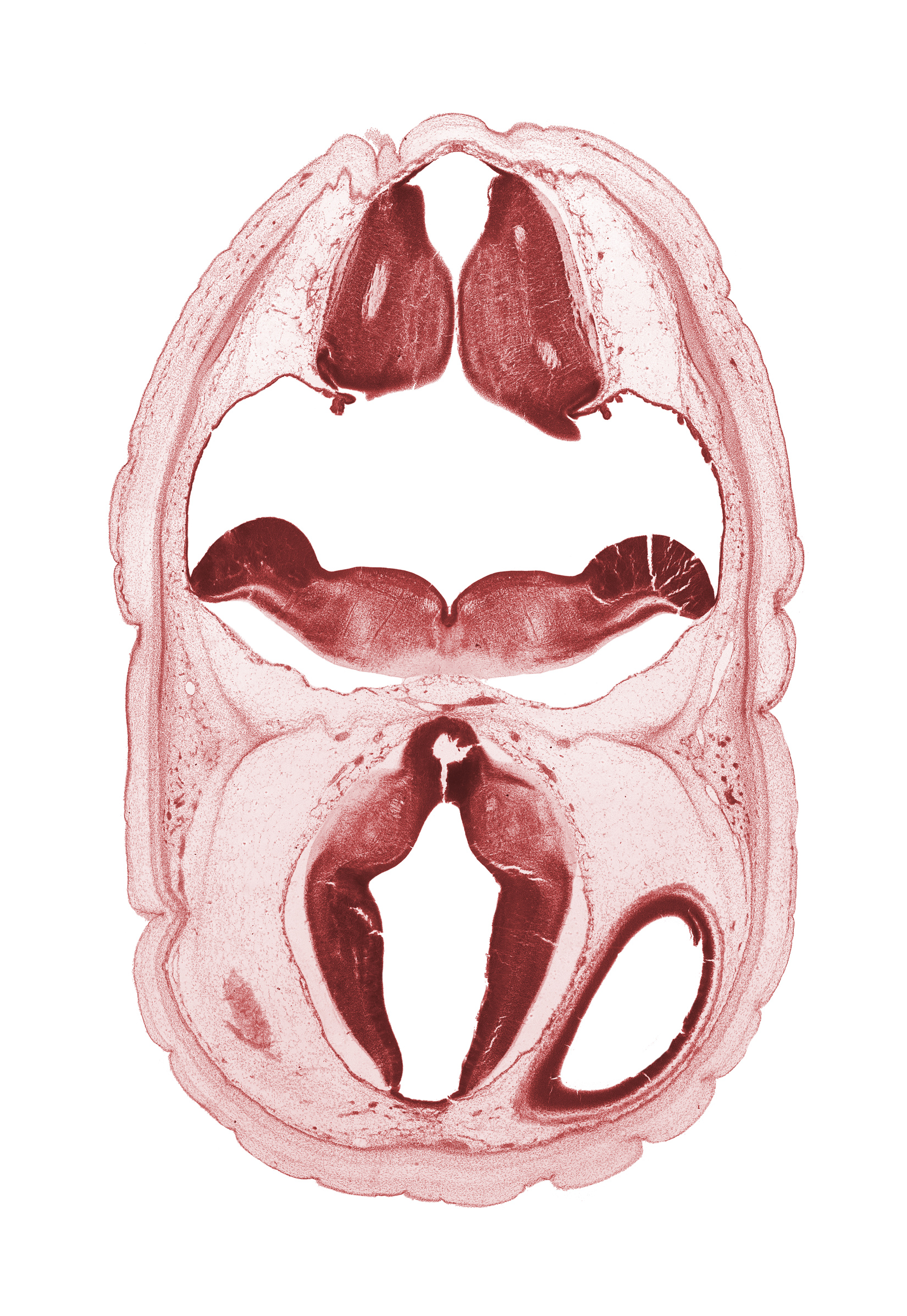 alar plate of myelencephalon, artifact fracture(s), artifact space(s), dorsal thalamus, dural band for tentorium cerebelli, edge of cerebral vesicle (hemisphere), fiber tract, hypothalamic sulcus, lateral ventricle, median sulcus, oculomotor nerve (CN III), osteogenic layer, subarachnoid space, superficial vascular plexus, surface ectoderm, third ventricle