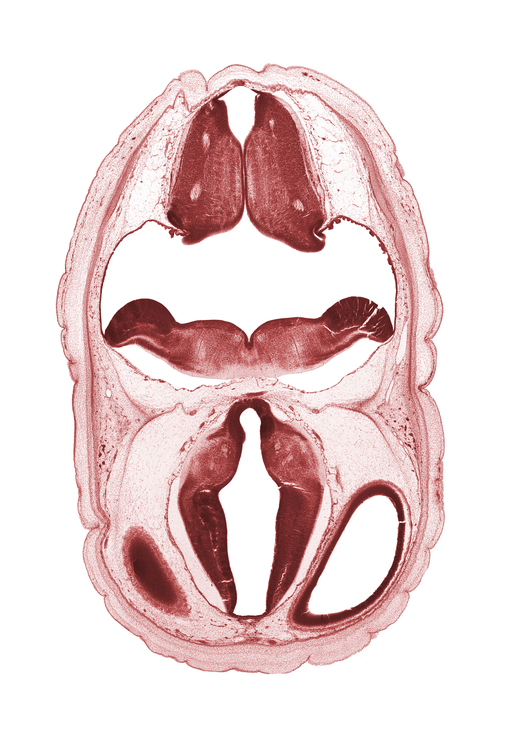 artifact space(s), diencephalon, dorsal thalamus, dural band for tentorium cerebelli, fiber tract, hypothalamus, metencephalon, myelencephalon, obex, oculomotor nerve (CN III), osteogenic layer, roof plate, roof plate of diencephalon, subarachnoid space, ventral thalamus, wall of cerebral vesicle (hemisphere)