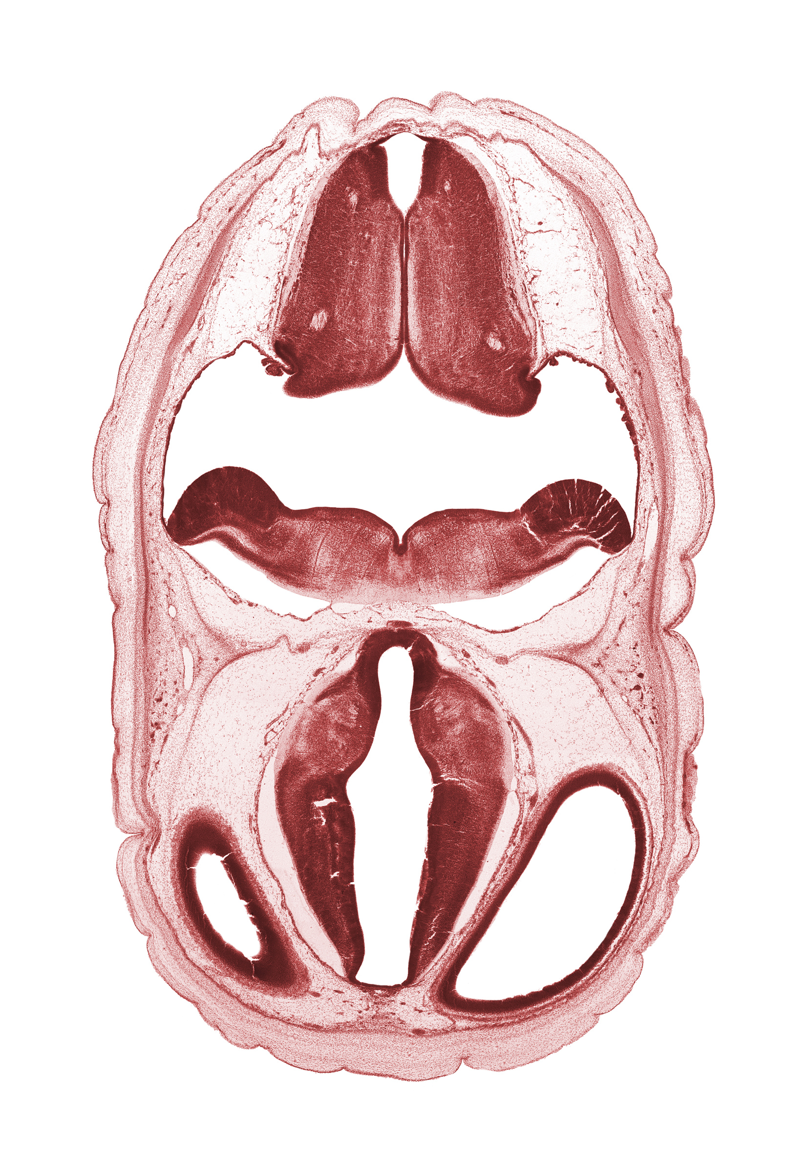 alar plate of metencephalon (cerebellum), artifact space(s), basal plate, edge of lateral ventricle, exoccipital, head mesenchyme, hypothalamic sulcus, hypothalamus, myelencephalon, oculomotor nerve (CN III), osteogenic layer, posterior communicating artery, subarachnoid space, sulcus limitans, surface ectoderm, trochlear nerve (CN IV), vascular plexus