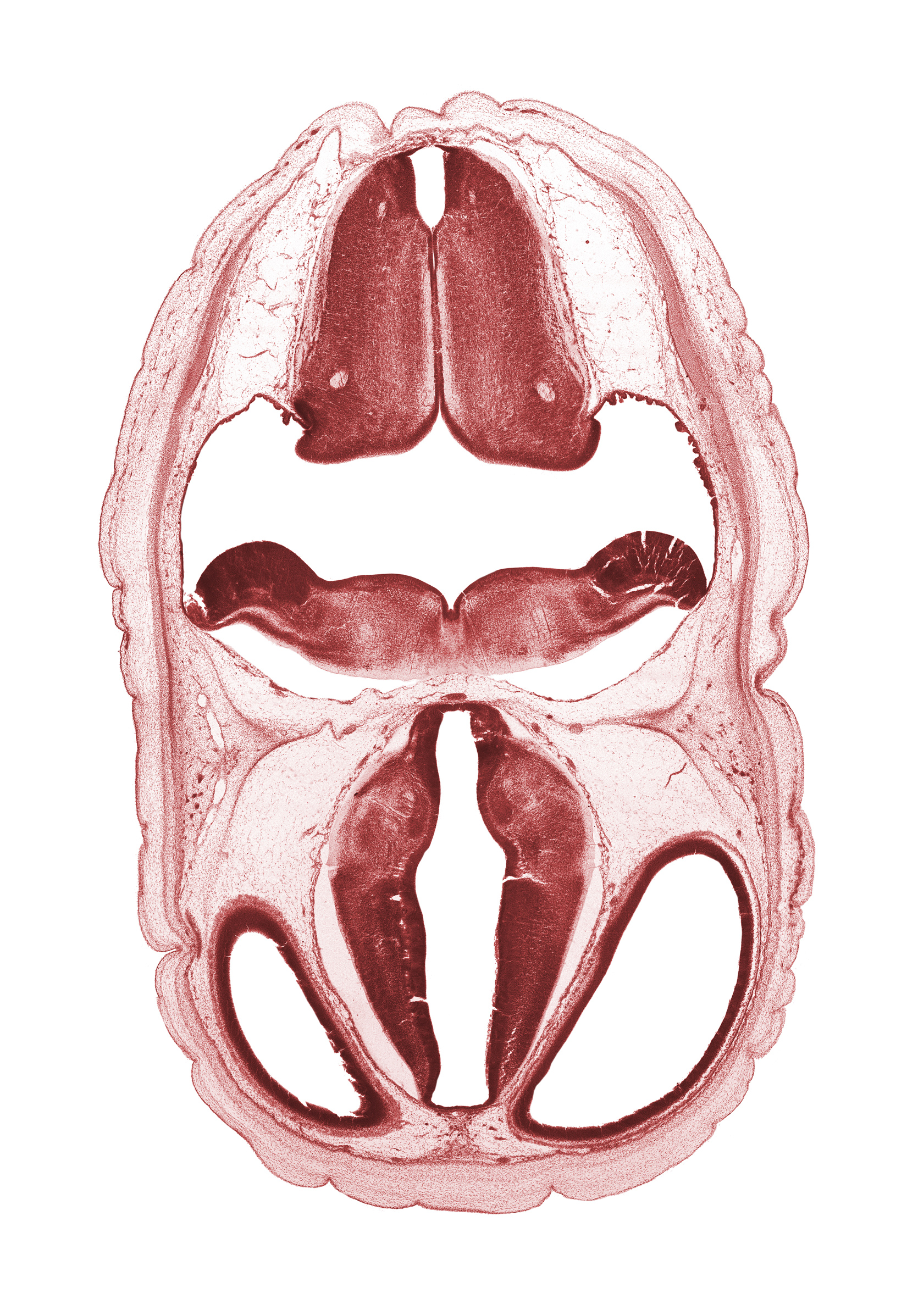 alar plate(s), artifact space(s), basal plate, dorsal thalamus, dural band for tentorium cerebelli, floor plate, hypothalamic sulcus, hypothalamus, lateral ventricle, obex, rhombencoel (fourth ventricle), roof plate, subarachnoid space, sulcus dorsalis, sulcus medius, third ventricle, ventral thalamus