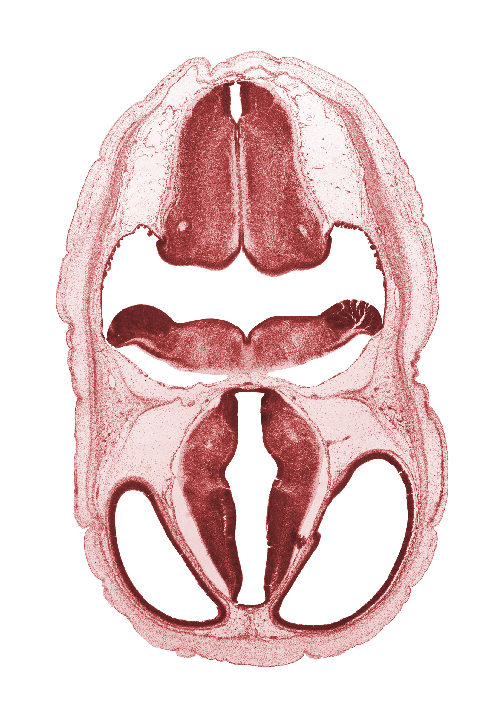 alar plate(s), artifact fracture(s), artifact space(s), basal plate, decussation in floor plate, hypothalamic sulcus, lateral ventricle, obex, posterior communicating artery, rhombencoel (fourth ventricle), sulcus dorsalis, sulcus limitans, third ventricle, venous plexus(es)