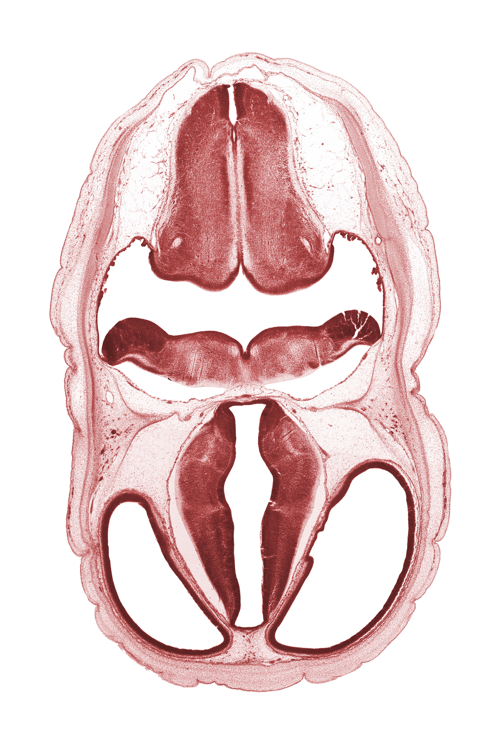 alar plate(s), artifact space(s), basal plate, basilar artery, caudal part of obex, decussation in floor plate of myelencephalon, exoccipital, fiber tract, head mesenchyme, hypothalamic sulcus, hypothalamus, lateral ventricle, median sulcus, posterior communicating artery, roof plate of myelencephalon, subarachnoid space, surface ectoderm, third ventricle, venous plexus(es)