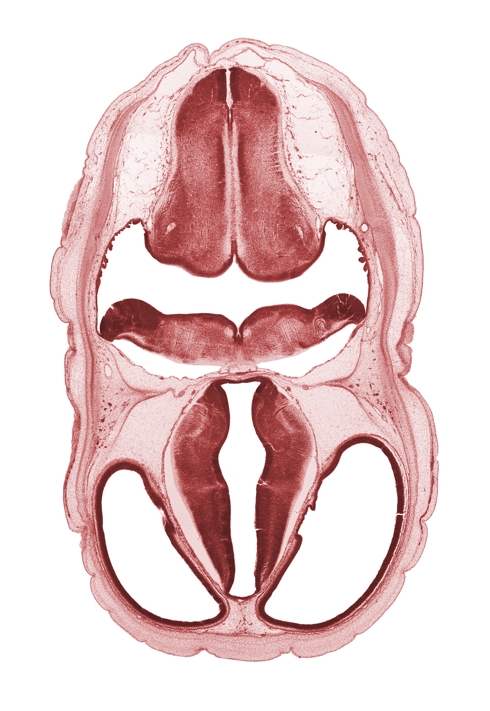 artifact space(s), decussation in floor plate of myelencephalon, dorsal thalamus, dural band for tentorium cerebelli, endolymphatic sac, fiber tract, hypothalamus, rhombencoel (fourth ventricle), roof plate of diencephalon, root of vagus nerve (CN X), stem of posterior dural venous plexus, venous plexus(es), ventral thalamus, zona limitans intrathalamica
