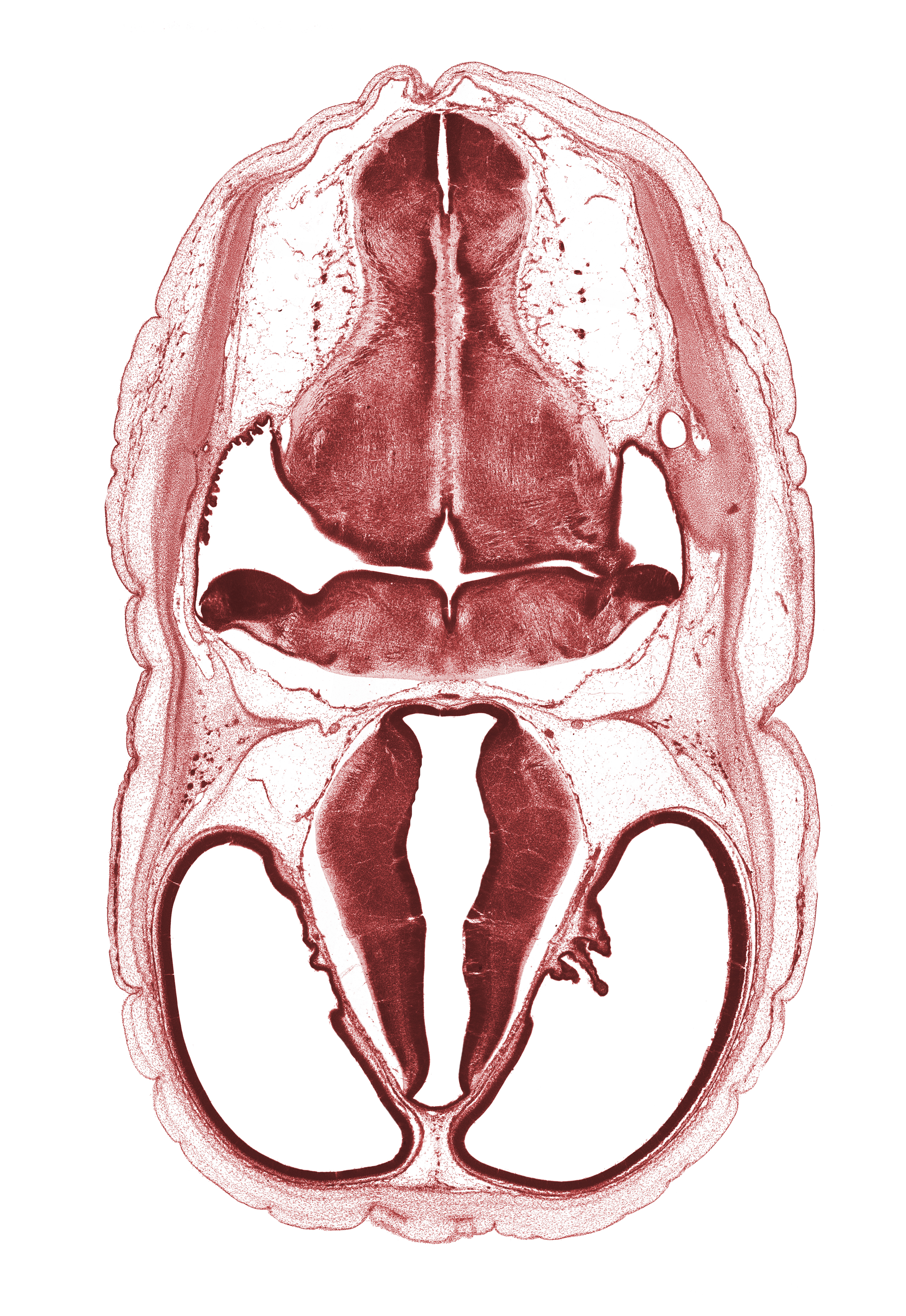 artifact space(s), cerebral vesicle (telencephalon), dural band for tentorium cerebelli, endolymphatic duct, endolymphatic sac, hypothalamic sulcus, lateral recess of rhombencoel (fourth ventricle), lateral ventricle, median sulcus, oculomotor nerve (CN III), osteogenic layer, rhombencoel (fourth ventricle), root of glossopharyngeal nerve (CN IX), root of vagus nerve (CN X), subarachnoid space, sulcus dorsalis, sulcus medius, third ventricle, trochlear nerve (CN IV), venous plexus(es)