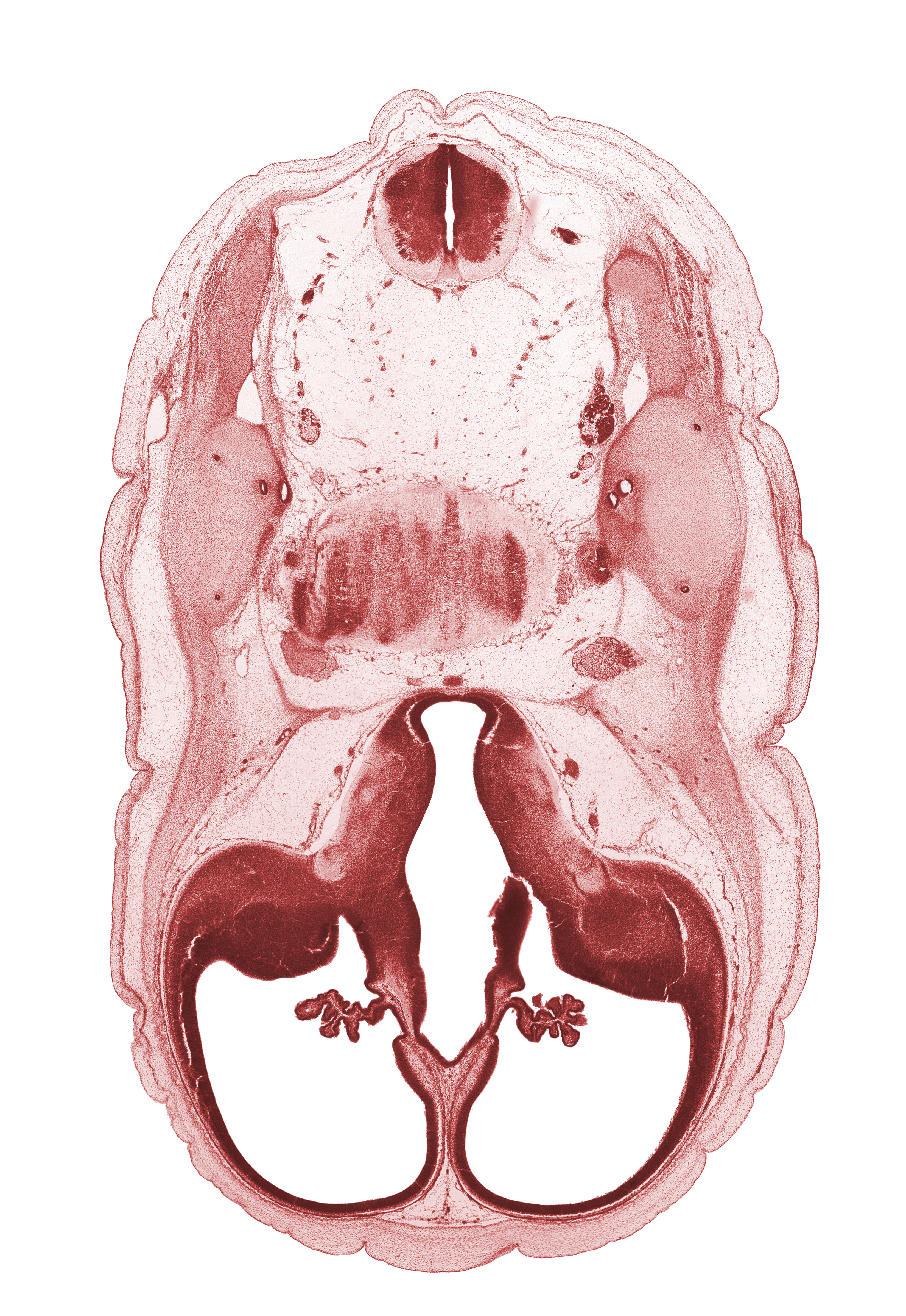 accessory nerve (CN XI), anterior semicircular duct, basilar artery, cerebral vesicle (hemisphere), common crus, edge of interventricular foramen, facial nerve (CN VII), glossopharyngeal nerve (CN IX), lateral ventricle, lateral ventricular eminence (telencephalon), posterior communicating artery, posterior semicircular duct, third ventricle, vagus nerve (CN X), vestibulocochlear nerve (CN VIII)
