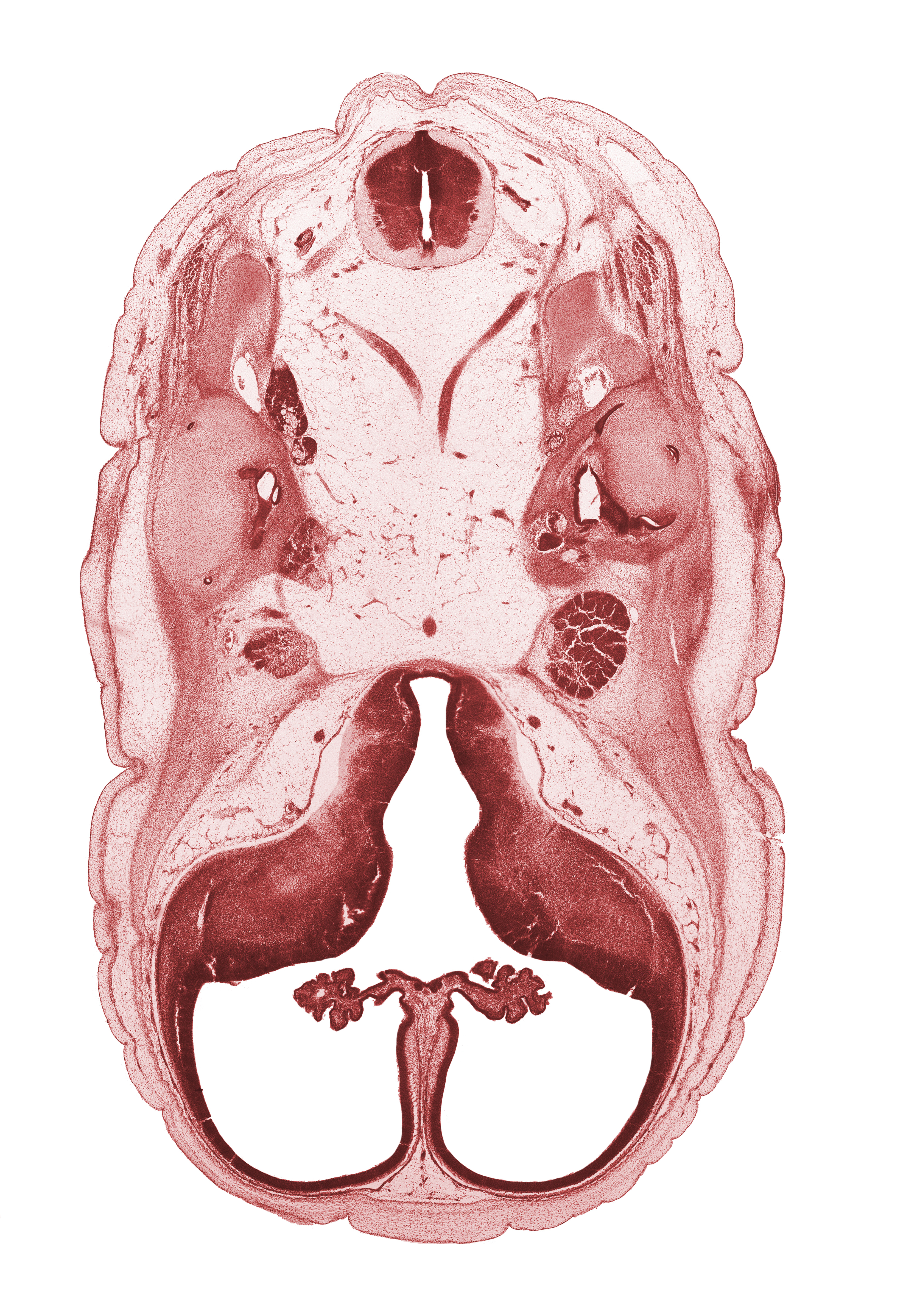anterior semicircular duct, artifact separation(s), basilar artery, central canal, cephalic edge of auricle, corpus striatum, exoccipital, facial nerve (CN VII), glossopharyngeal nerve (CN IX), hypoglossal nerve (CN XII), lateral ventricular eminence (telencephalon), medial ventricular eminence (diencephalon), posterior communicating artery, posterior semicircular duct, subarachnoid space, trigeminal ganglion (CN V), utricle, vagus nerve (CN X), vertebral artery, vestibulocochlear ganglion (CN VIII)