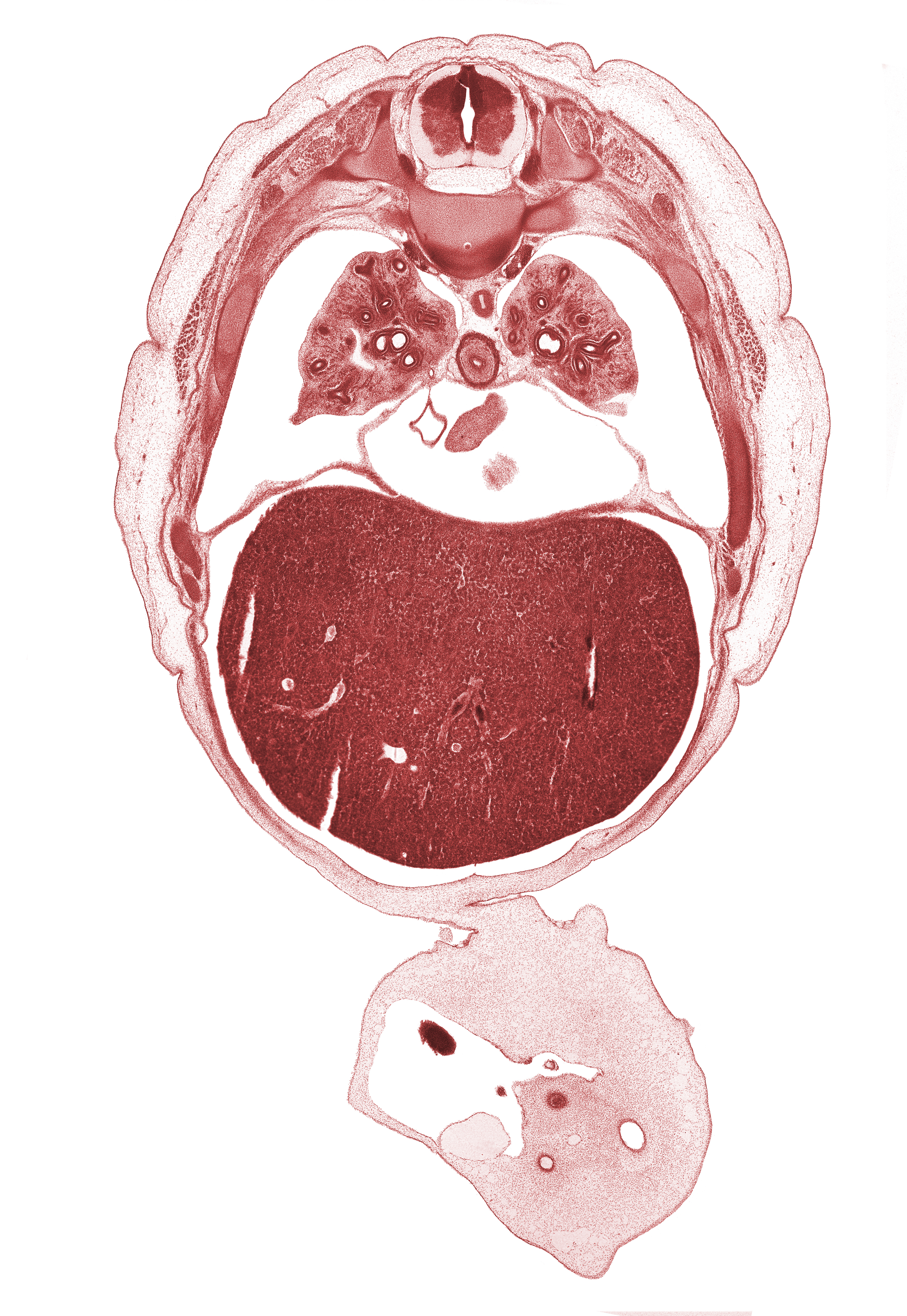 S-1 spinal nerve, T-6 spinal ganglion, allantois, artifact separation(s), caudal edge of left ventricle, caudal edge of right atrium, central tendon of diaphragm, edge of herniated midgut, head of rib 7, inferior vena cava, junction of abdominal wall and umbilical cord, left lobe of liver, left umbilical artery, lower lobe of left lung, lower lobe of right lung, lower secondary bronchus, muscular part of diaphragm, pericardial cavity, peritoneal cavity, pleural cavity, right lobe of liver, right lower pulmonary vein, right umbilical artery, sympathetic trunk, umbilical vein
