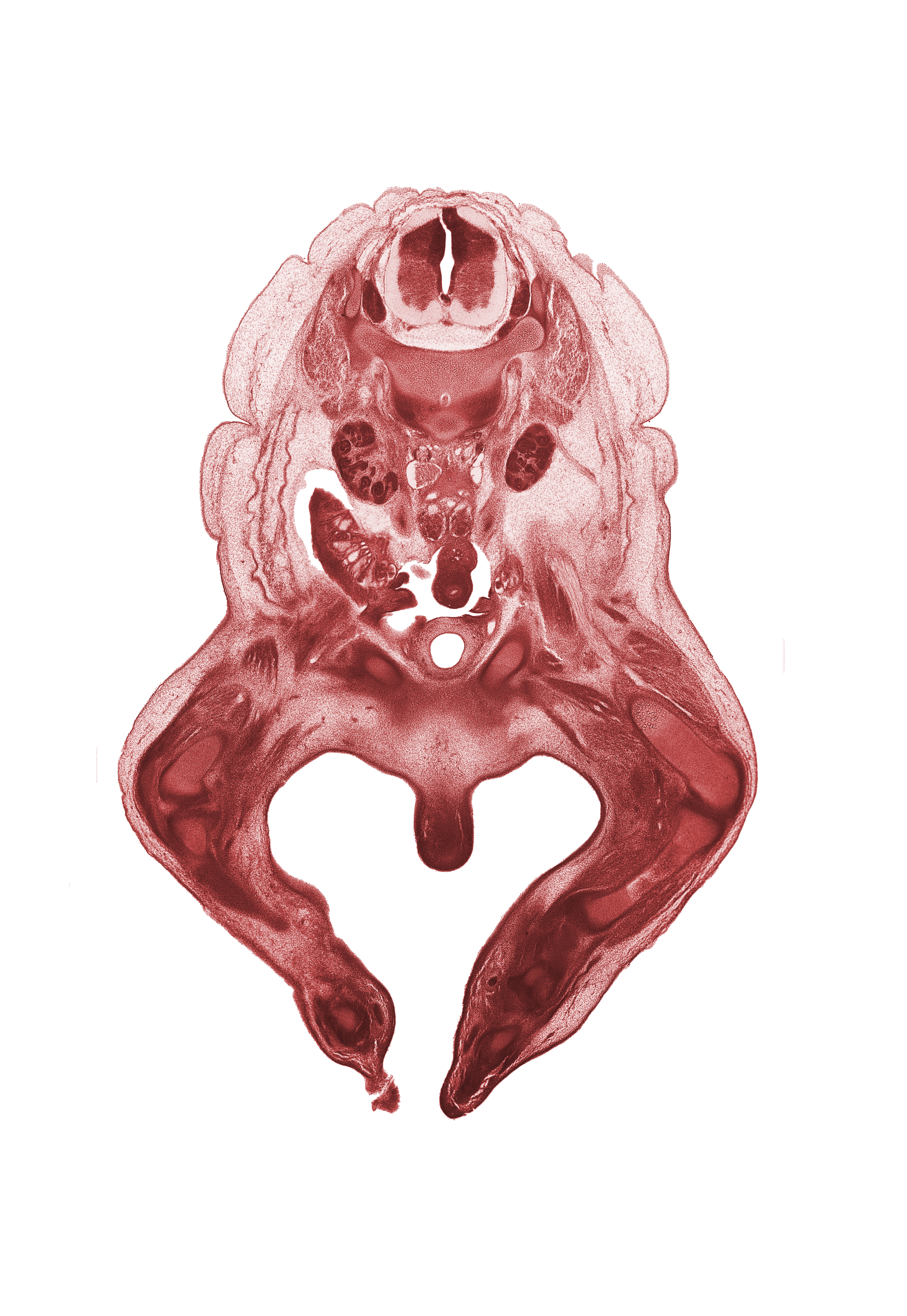L-1 spinal ganglion, L-2 spinal ganglion, artifact fracture(s), clitoris, femoral nerve, femur, hindgut, kidney (metanephros), knee joint, labial swelling (labium major), median sacral artery, metatarsal(s), patella, psoas major muscle, pubis, quadriceps femoris muscle, right common iliac artery, tarsal region, tibia, ureter