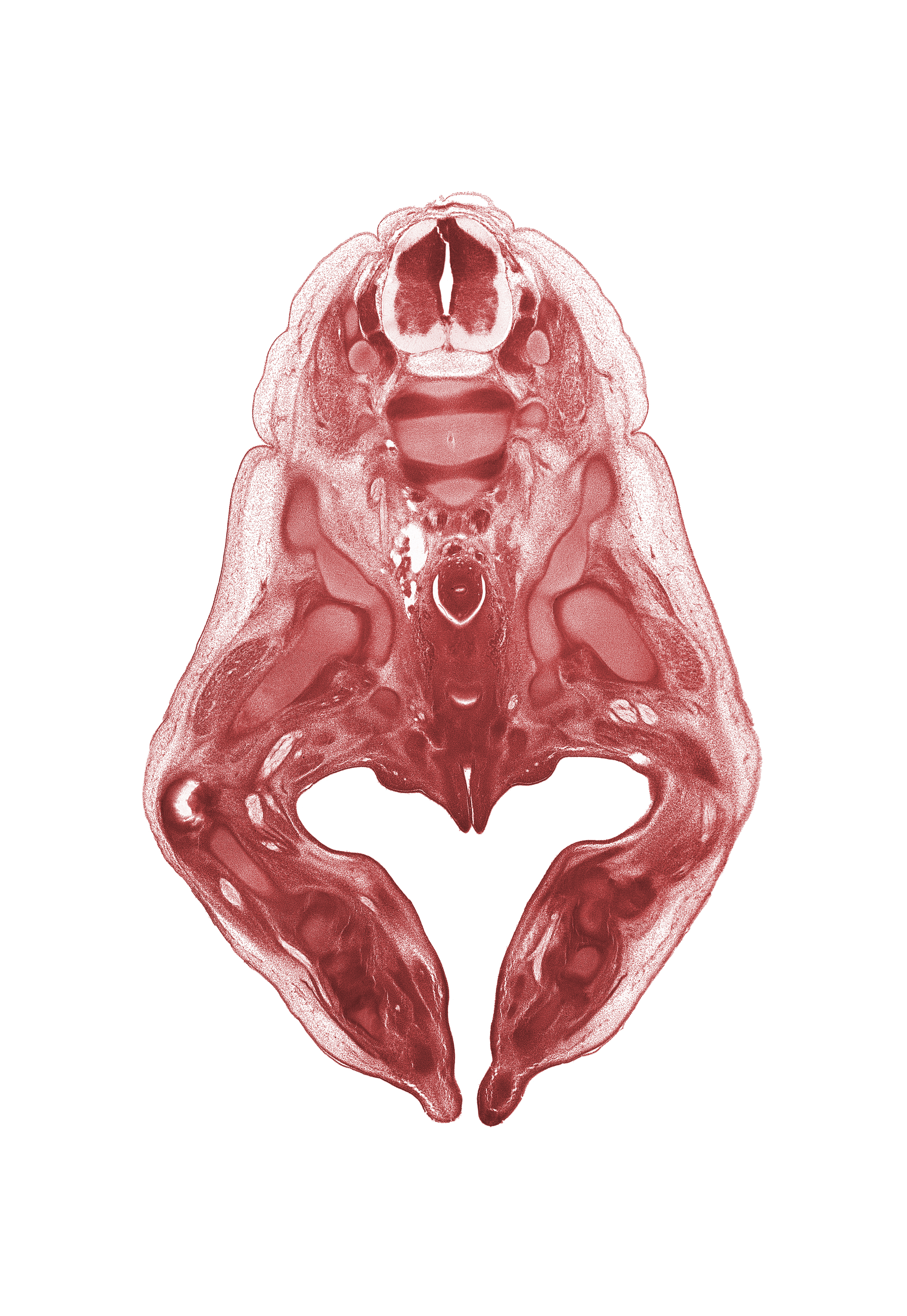 L-2 spinal ganglion, L-3 / L-4 intervertebral disc, L-3 spinal ganglion, L-3 spinal nerve, artifact fracture(s), common fibular nerve, dorsum of foot, femur, fibula, fibular nerve, hip joint, ilium, ischium, labial swelling, labium minor, neural arch of L-4 vertebra, notochord, perineal nerve , rectum, sciatic nerve, tibia, tibial nerve, toe, urethra, vaginal vestibule