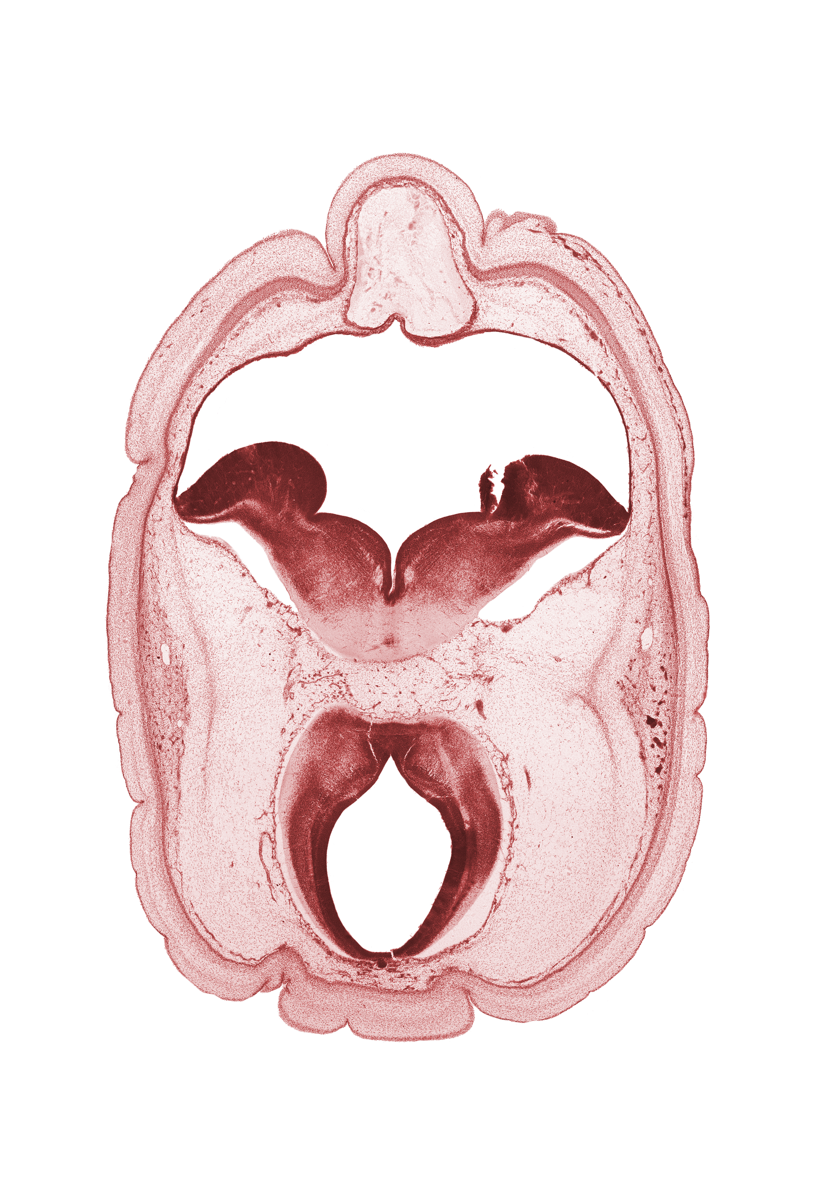 alar plate(s), artifact fracture(s), artifact space(s), basal plate, diverticulum of rhombencoel (fourth ventricle), intermediate zone, marginal zone, mesencephalon, metencephalon, middle dural venous plexus, oculomotor nerve (CN III), pons region (metencephalon), posterior cerebral artery, rhombencoel (fourth ventricle), roof plate, ventricular zone