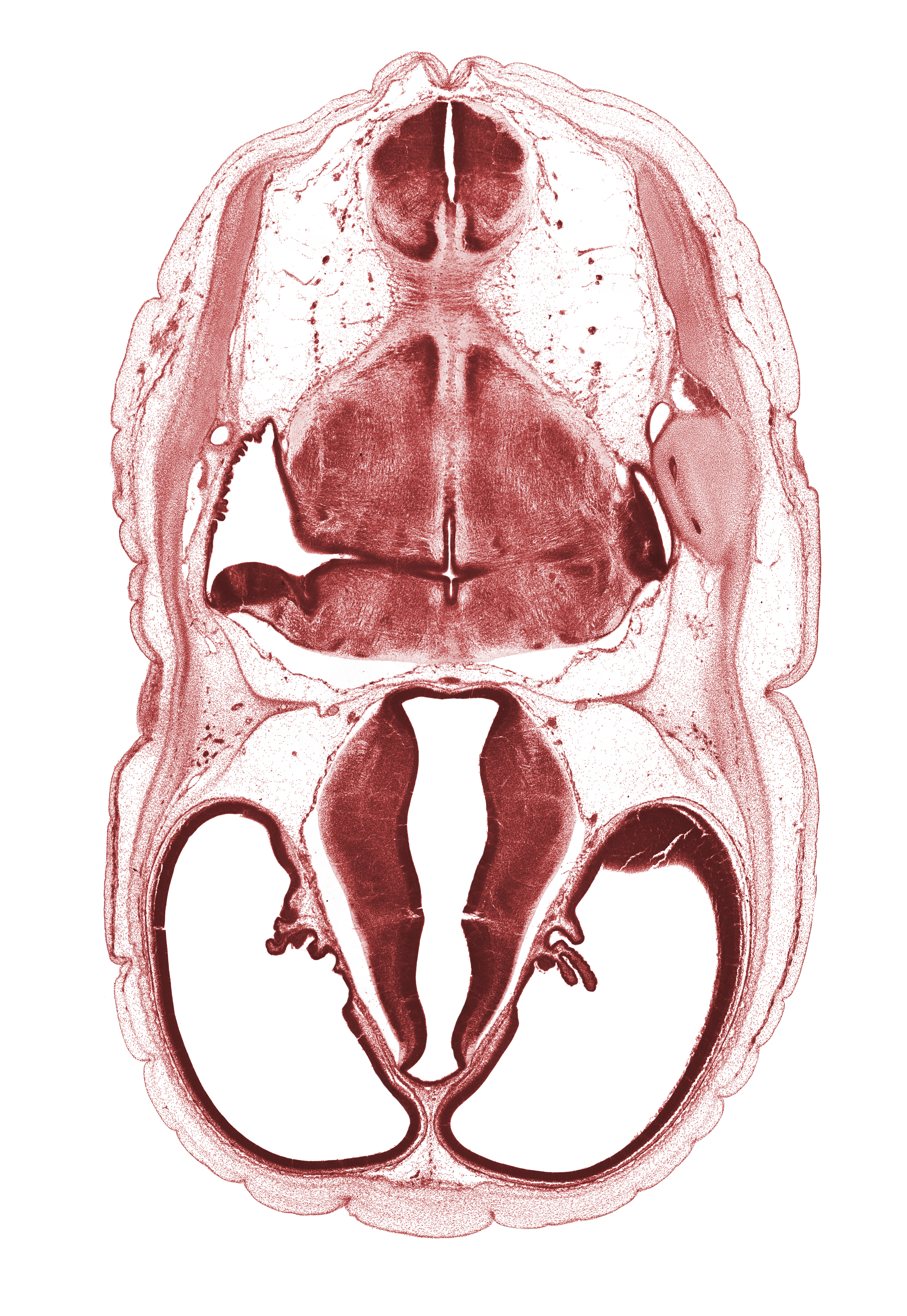 alar plate(s), basal plate, choroid plexus, decussation in floor plate, dorsal thalamus, dural band for tentorium cerebelli, endolymphatic duct, glossopharyngeal nerve (CN IX), hypothalamic sulcus, hypothalamus, lateral recess of rhombencoel (fourth ventricle), lateral ventricle, marginal ridge, oculomotor nerve (CN III), osteogenic layer, roof plate of myelencephalon, root of vagus nerve (CN X), sigmoid sinus, sulcus dorsalis, sulcus limitans, trochlear nerve (CN IV), venous plexus(es), ventral thalamus