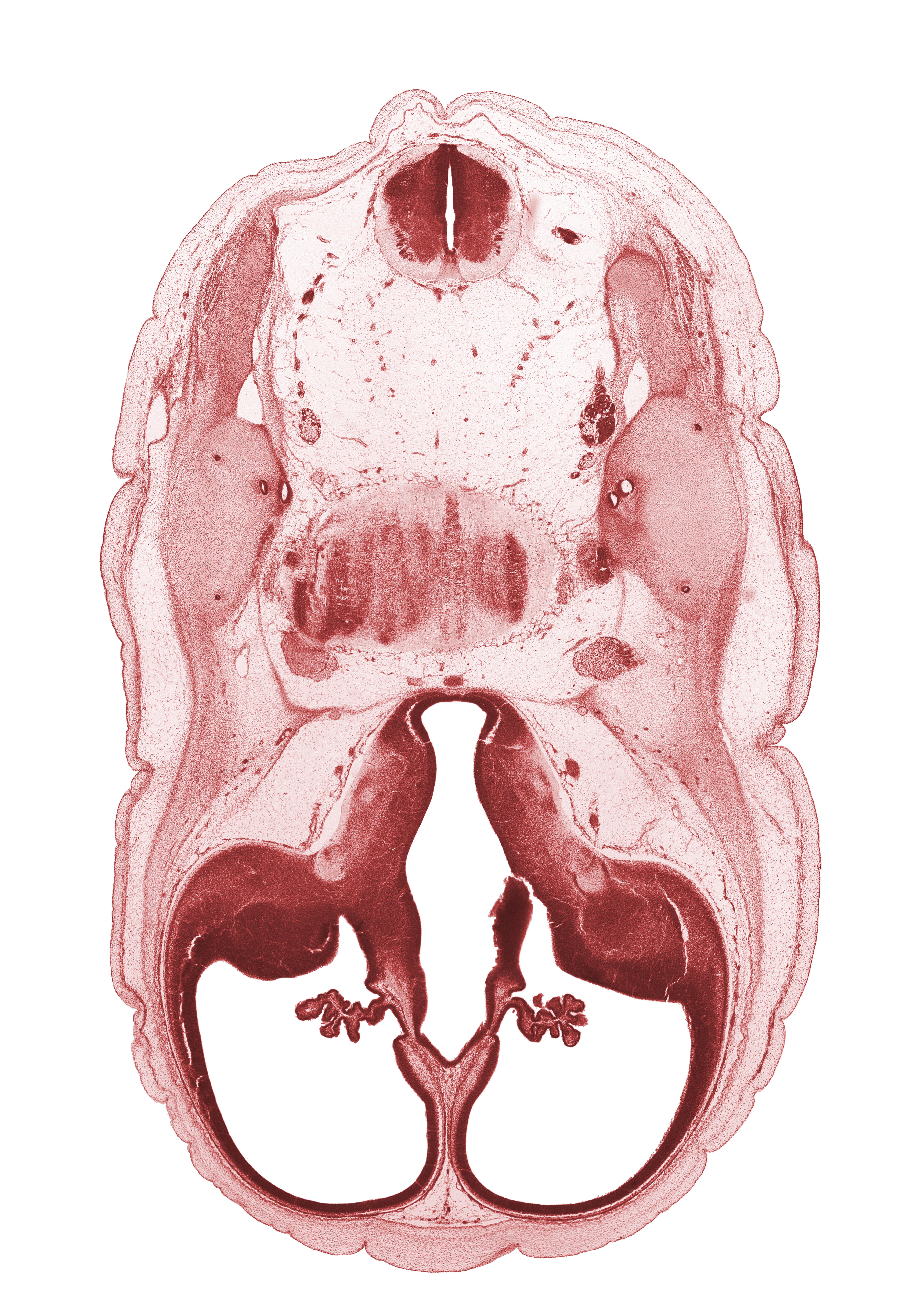 accessory nerve (CN XI), anterior semicircular duct, basilar artery, cerebral vesicle (hemisphere), common crus, edge of interventricular foramen, facial nerve (CN VII), glossopharyngeal nerve (CN IX), lateral ventricle, lateral ventricular eminence (telencephalon), posterior communicating artery, posterior semicircular duct, third ventricle, vagus nerve (CN X), vestibulocochlear nerve (CN VIII)