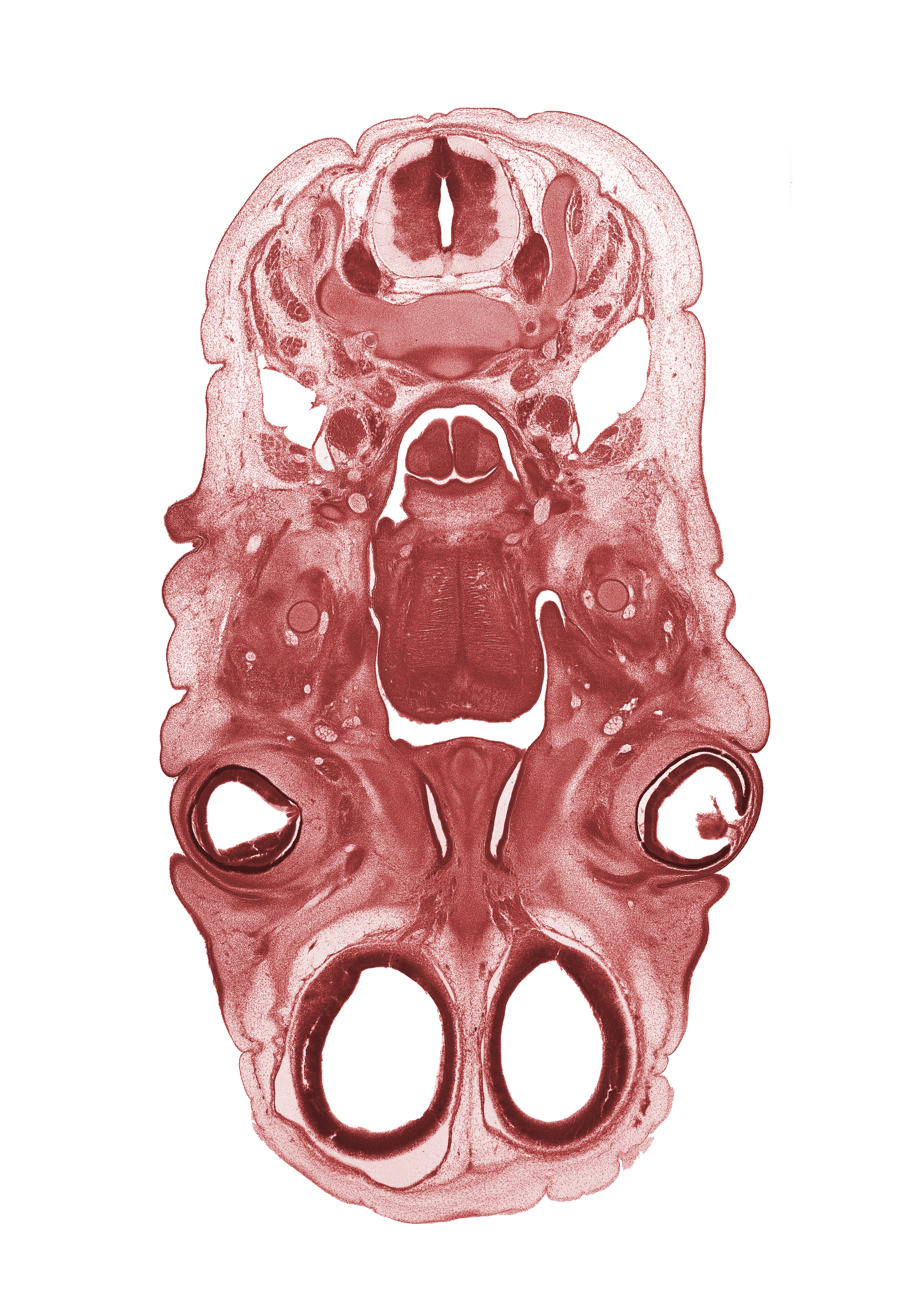C-4 spinal ganglion, arytenoid swelling, epiglottis, falx cerebri region, glossopharyngeal nerve (CN IX), hypoglossal nerve (CN XII), intermediate zone, intraretinal space (optic vesicle cavity), jugular lymph sac, lens, levator palprebae superioris muscle, marginal zone, olfactory bulb, olfactory epithelium (placode), olfactory filia (CN I), optic cup cavity, osteogenic layer, pharyngeal arch 1 cartilage (Meckel), pterygoid muscle blastema, upper eyelid, ventricular zone