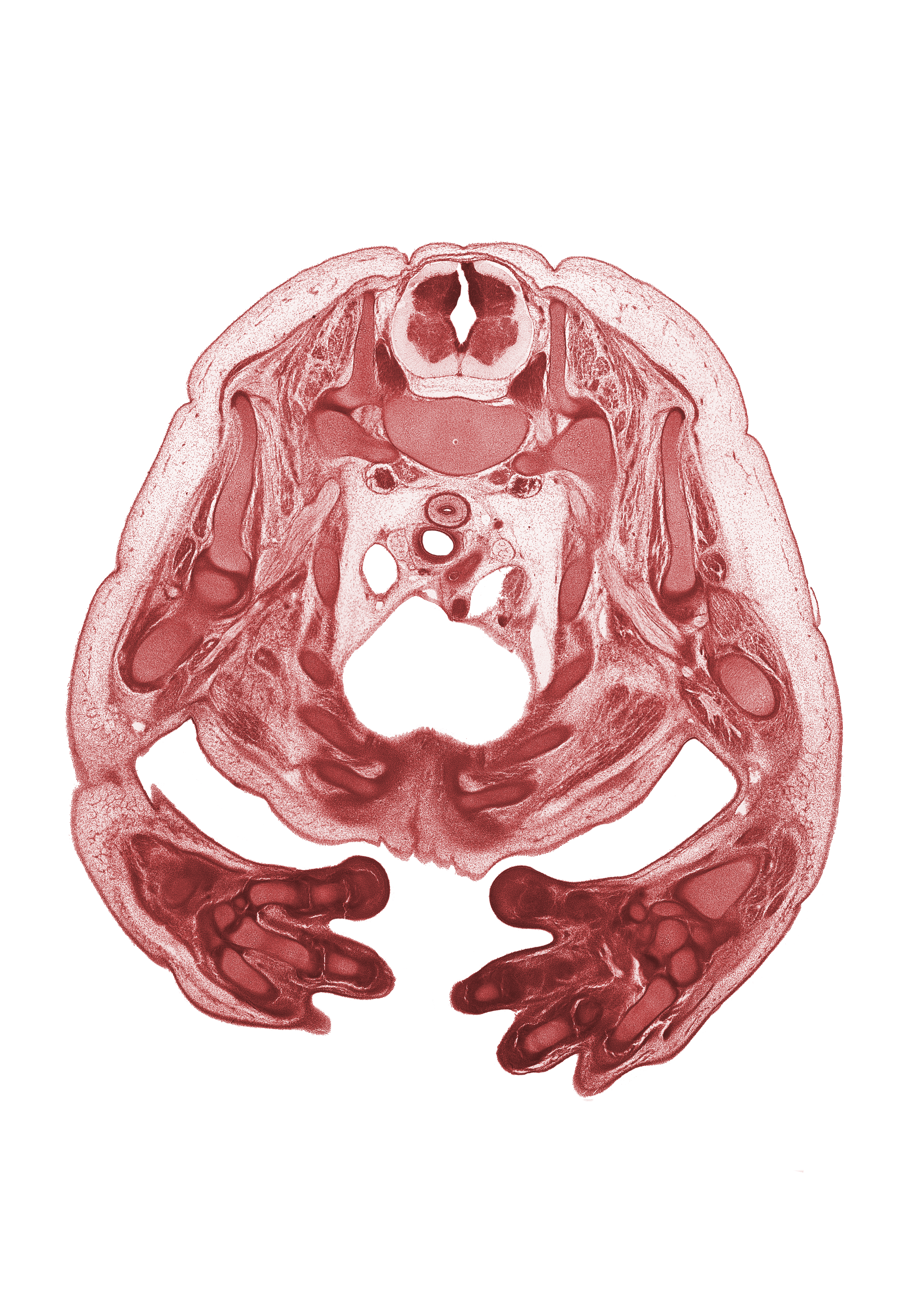T-1 intercostal nerve, T-1 spinal ganglion, T-1 spinal nerve, brachial artery, brachial plexus, caudal edge of thymus gland, cephalic edge of left pleural cavity, esophagus muscularis, hemisternum, left digit 1 (thumb), lunate, median nerve, metacarpal 2, metacarpal 4, notochord, pericardial cavity, radius, rib 1, rib 2, rib 3, rib 4, rib 5, scapula, subarachnoid space, superior vena cava, trachea