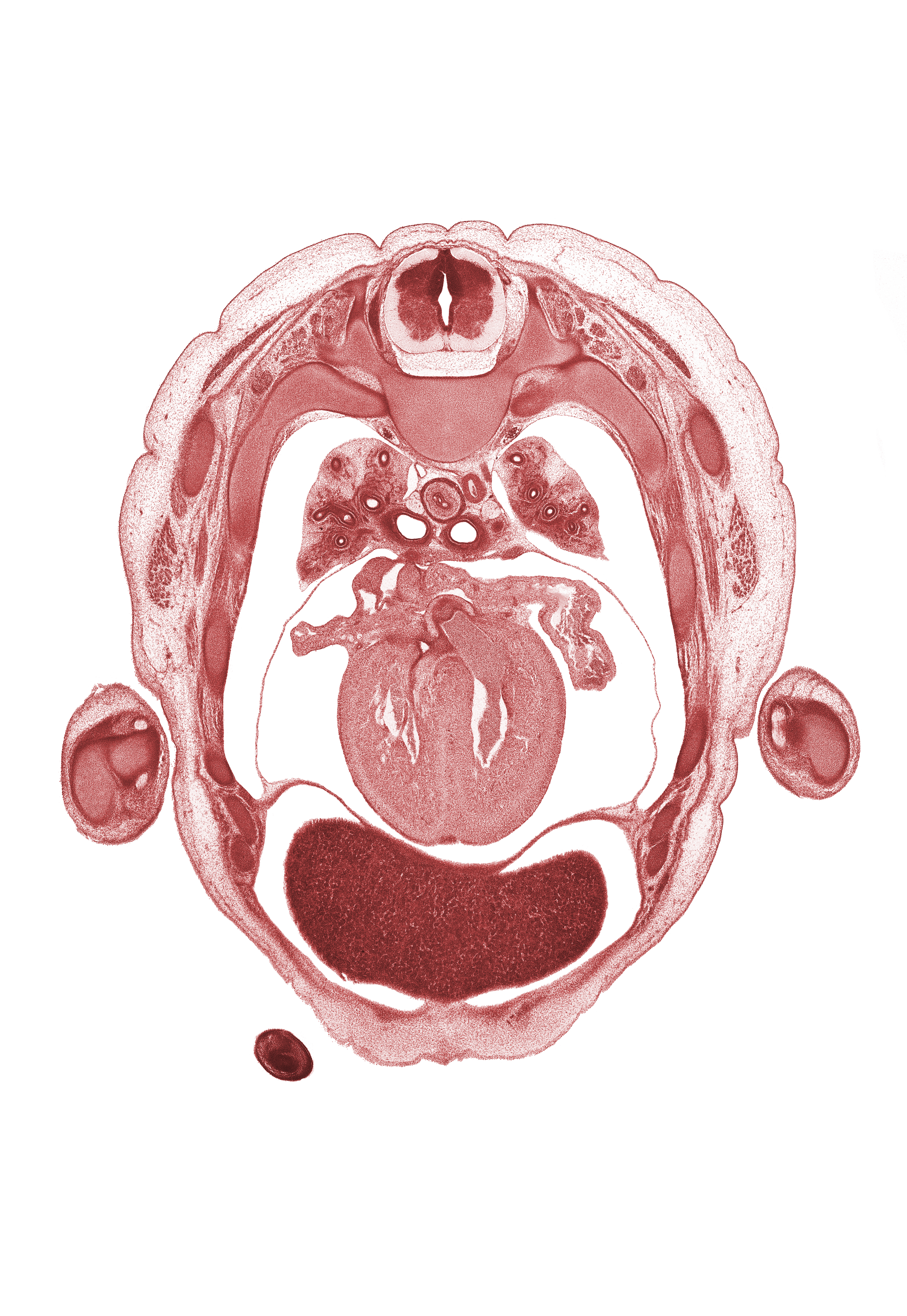 T-3 / T-4 interganglion region, aorta, auricle of left atrium, auricle of right atrium, azygos vein, digits (fingers), lower lobe of left lung, muscular part of interventricular septum, olecranon process of ulna, pericardial sac, pulmogenic coat, radius, rib 4, rib 5, rib 6, sinus venosus, subarachnoid space, sympathetic trunk, ulnar nerve, upper lobe of left lung