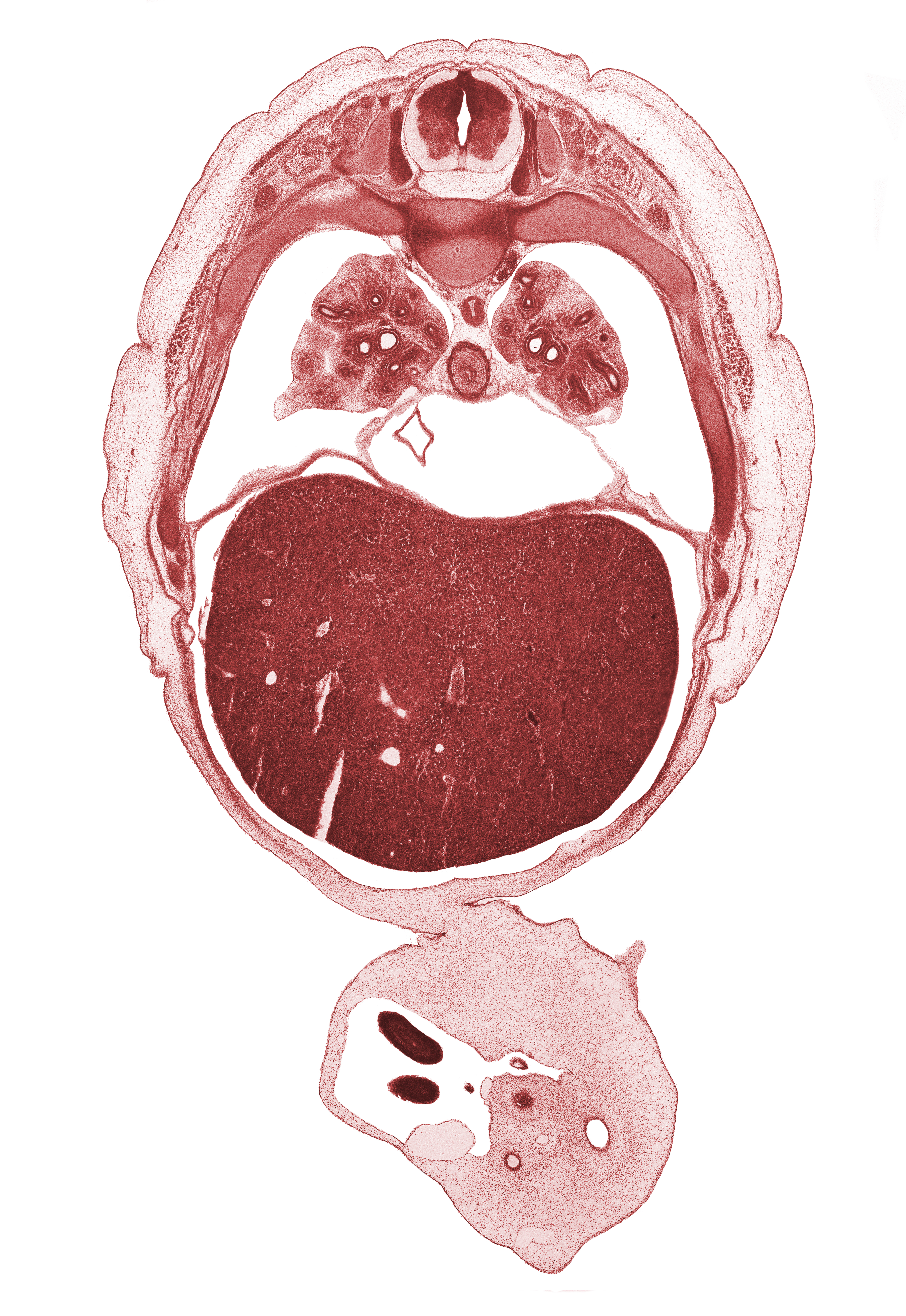 T-6 spinal ganglion, artifact separation(s), distal limb of herniated midgut, edge of herniated midgut, inferior vena cava, left umbilical artery, liver prominence, lower lobe of right lung, pericardial cavity, peritoneal cavity, pleural cavity, pulmogenic coat, rib 7, rib 8, rib 9, right umbilical artery, umbilical cord, umbilical vein