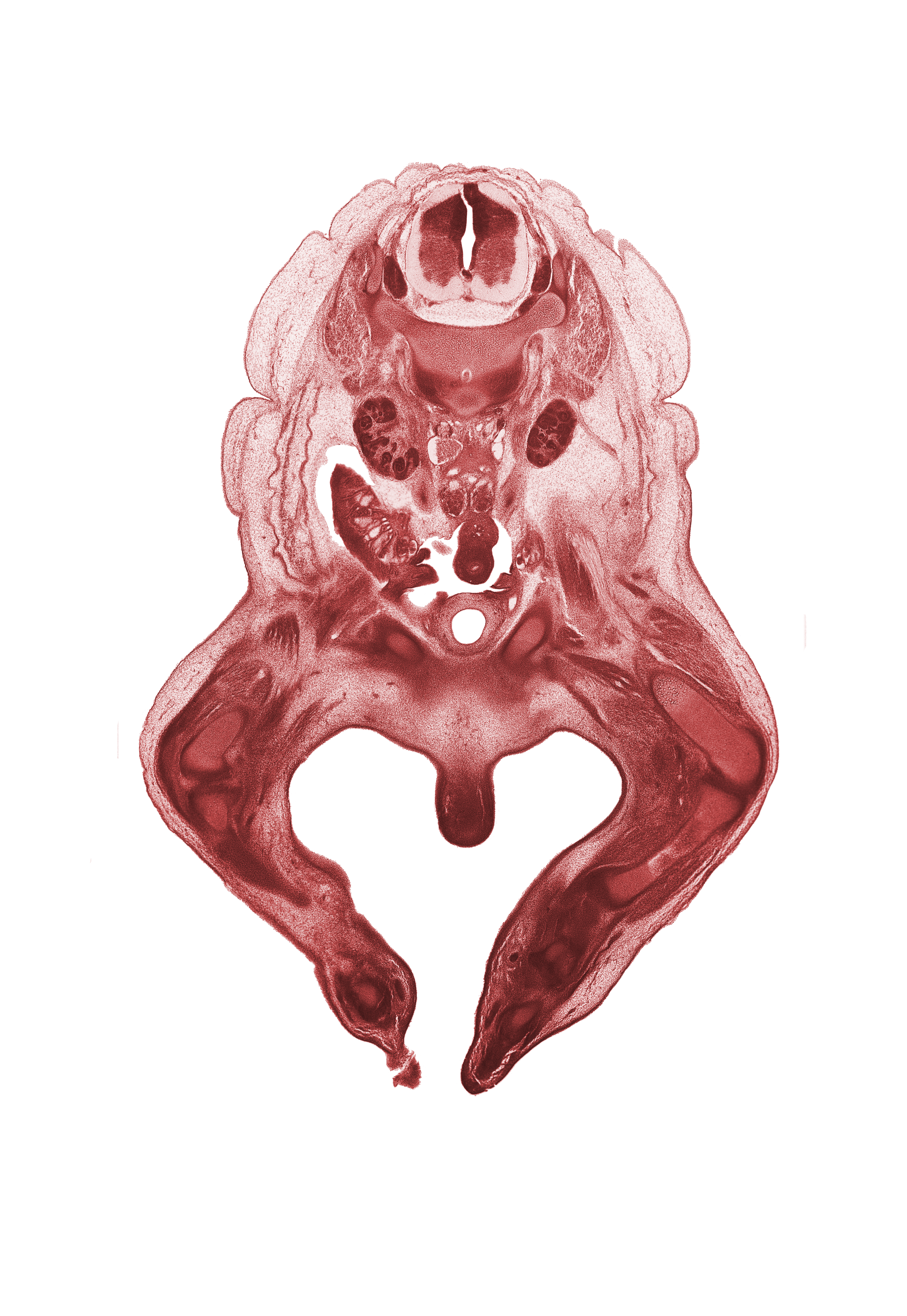 L-1 spinal ganglion, L-2 spinal ganglion, artifact fracture(s), clitoris, femoral nerve, femur, hindgut, kidney (metanephros), knee joint, labial swelling (labium major), median sacral artery, metatarsal(s), patella, psoas major muscle, pubis, quadriceps femoris muscle, right common iliac artery, tarsal region, tibia, ureter