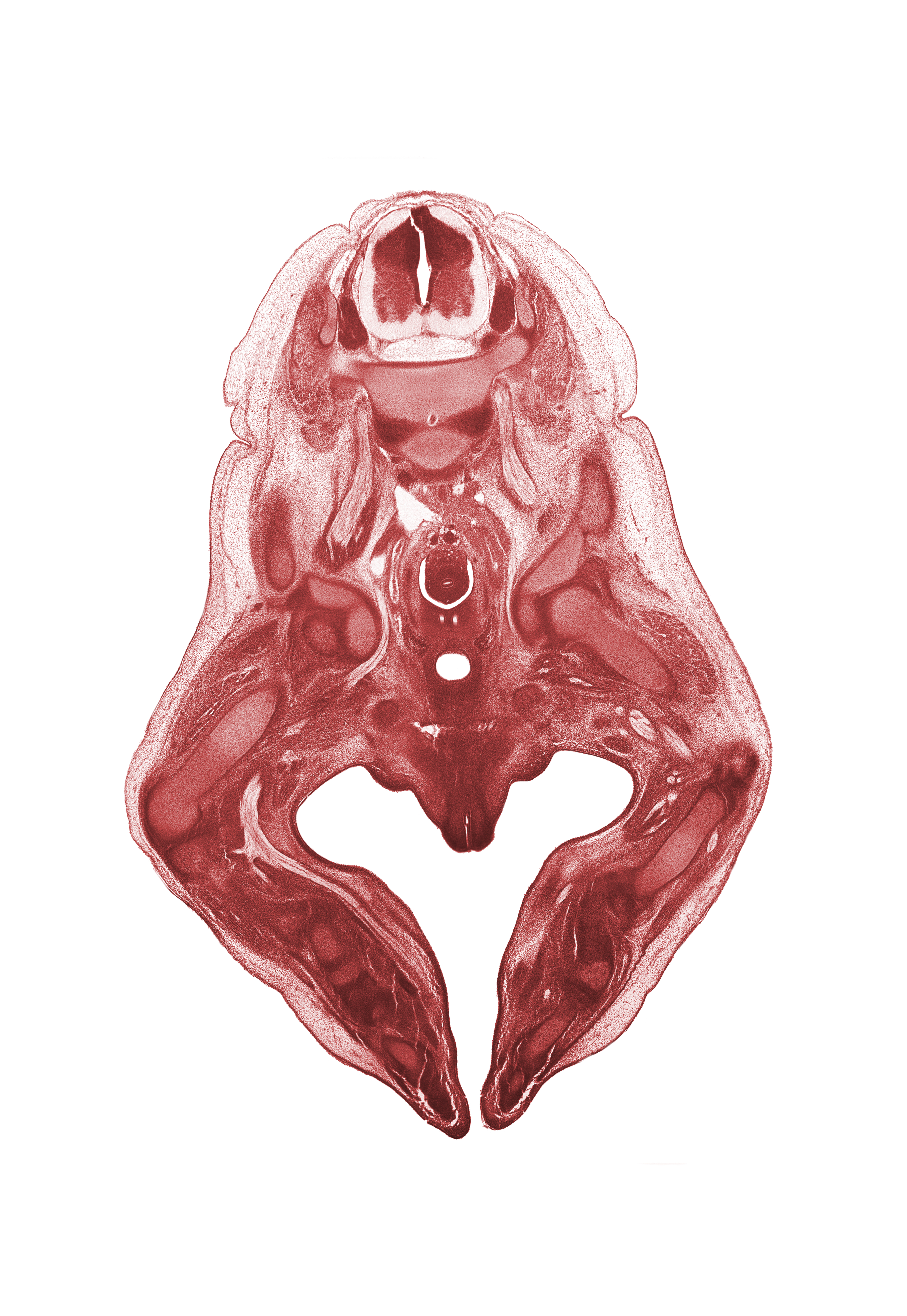L-2 spinal ganglion, L-3 spinal ganglion, artifact fracture(s), central canal, cephalic edge of vaginal vestibule, corpus cavernosum (crus of clitoris), dorsal nerve of clitoris, femur, head of femur, hindgut, hip joint, ilium, internal iliac artery, labial swelling (labium major), labium minor, lumbar plexus, median sacral artery, notochord, paramesonephric duct, peritoneal cavity, proximal phalynx (foot), pubis, tarsal cartilage(s), tibia, tibial nerve, urinary bladder