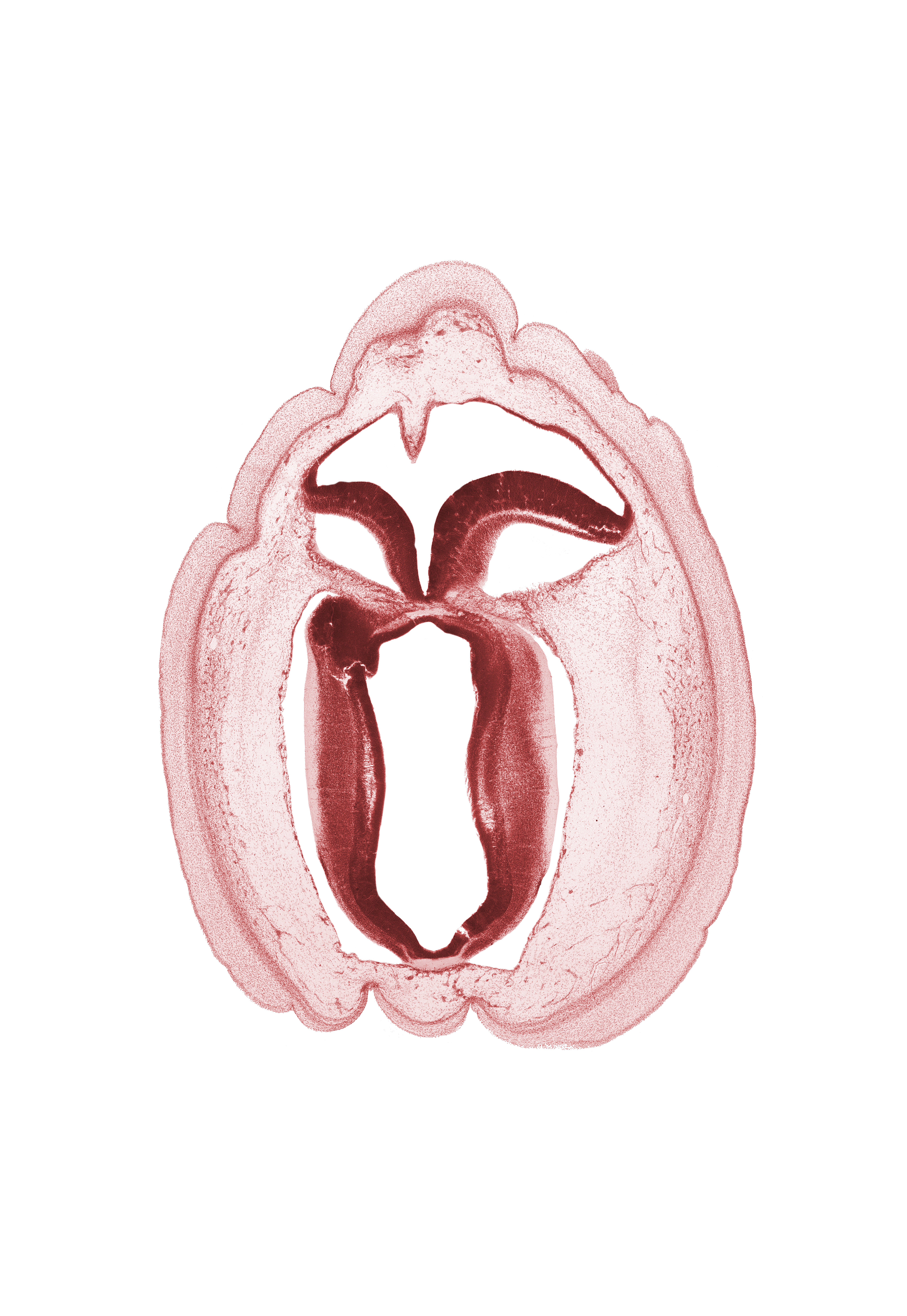 artifact space(s), cerebral aqueduct (longitudinal section), commissure in roof plate of mesencephalon, fiber tract, head mesenchyme, osteogenic layer, rhombencoel (fourth ventricle), subarachnoid space, surface ectoderm, trochlear nerve (CN IV)
