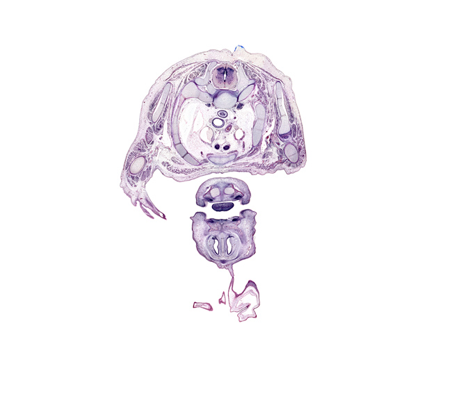 T-1 / T-2 interganglion region, T-1 / T-2 intervertebral disc, arch of aorta, biceps brachii muscle, body of tongue, brachialis muscle, cephalic edge of right pleural cavity, dorsal horn of grey matter, frontal prominence, head of rib 2, humerus, interorbital ligament, lateral horn of grey matter, left subclavian artery, lower lip, nasal capsule cartilage, nasal cavity (nasal sac), nasal septal cartilage, neural arch of T-1 vertebra, oral cavity, pharyngeal arch 1 cartilage (Meckel), primary palate, radial nerve, rib 1, right lobe of thymus gland, scapula, serratus anterior muscle, subscapularis muscle, superior vena cava, surface ectoderm, sympathetic trunk, transverse process of T-1 vertebra, upper lip, ventral horn of grey matter