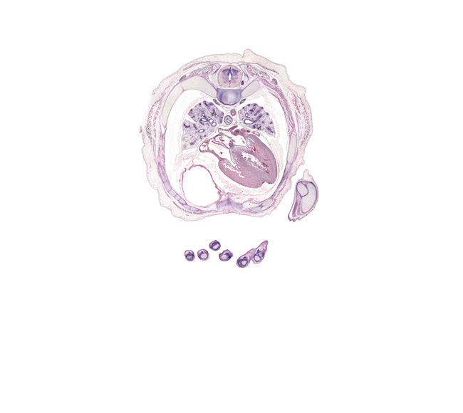 T-5 spinal ganglion, common left pulmonary vein, common right pulmonary vein, head of rib 6, interdigital notch, intermediate phalynx of left digit 3 (middle finger), interventricular sulcus, left ventricle, lower lobe of right lung, metacarpophalangeal joint of left digit 5 (little finger), middle lobe of right lung, muscular interventricular septum, oblique fissure, pericardial cavity, peritoneal cavity, pleural cavity, rib 6, rib 7, rib 8, right atrioventricular (tricuspid) valve, right atrium, right ventricle, secondary interatrial septum (septum secundum), secondary ostium, sympathetic trunk, trapezius muscle, volar surface of digit 3 (middle finger)