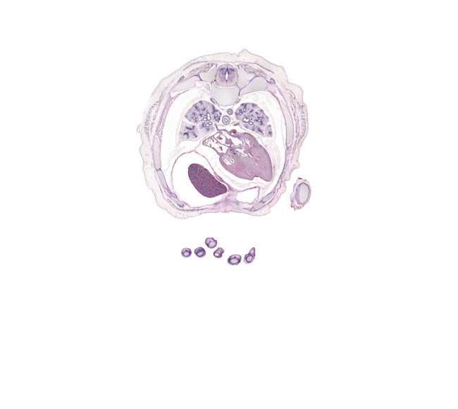 T-5 / T-6 interganglion region, apex of heart, central tendon of diaphragm, coronary sinus, distal phalynx of left digit 3 (middle finger), esophageal nerve plexus, head of rib 6, left lower pulmonary vein, lower lobe of left lung, lower lobe of right lung, middle lobe of right lung, oblique fissure, pericardial cavity, pericardial sac, peritoneal cavity, rib 6, rib 7, rib 8, right lobe of liver, right lower pulmonary vein, upper lobe of left lung