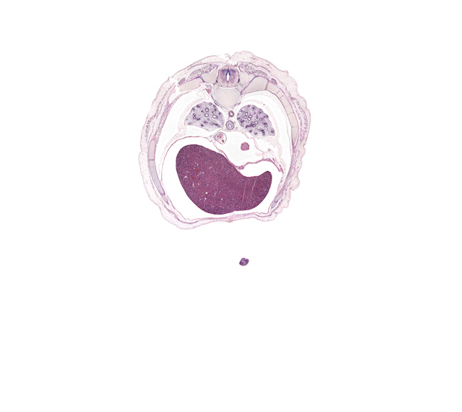 T-7 spinal ganglion, aorta, caudal edge of left ventricle, central tendon of diaphragm, costotransverse joint, costovertebral joint, esophageal nerve plexus, falciform ligament, iliocostalis muscle, inferior vena cava, latissimus dorsi muscle, left lobe of liver, longissimus muscle, lower lobe of left lung, lower lobe of right lung, muscular part of diaphragm, neural arch, pericardial cavity, peritoneal cavity, pulmonary ligament, rib 7, rib 8, rib 9, right lobe of liver, spinalis muscle, tip of digit 5 of left hand (little finger), transverse process of T-7 vertebra