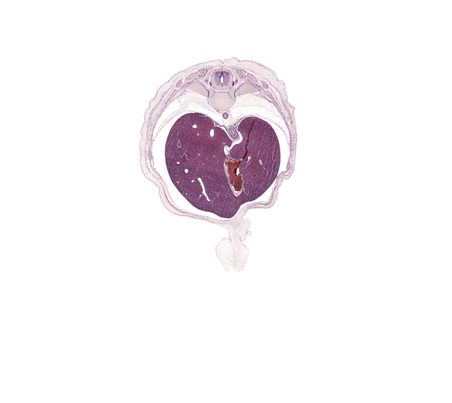 T-9 spinal ganglion, amnion on surface of umbilical cord, artifact(s), ductus venosus, esophagus endoderm, greater splanchnic nerve, iliocostalis muscle, inferior vena cava, left lobe of liver, longissimus muscle, osteogenic layer, pleural cavity, rib 10, right lobe of liver, spinalis muscle, surface ectoderm, umbilical cord
