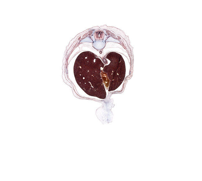 T-9 / T-10 interganglion region, afferent hepatic vein, aorta, costal margin, ductus venosus, esophageal hiatus in diaphragm, external abdominal oblique muscle, inferior vena cava, intermediate zone, internal abdominal oblique muscle, left lobe of liver, loose mesenchyme, marginal zone, posterior gastric nerve (CN X), rib 10, transversus abdominis muscle, umbilical cord, ventricular zone