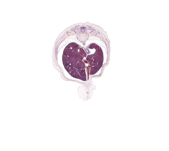 T-9 / T-10 interganglion region, afferent hepatic vein, amnion on surface of umbilical cord, aorta, caudate lobe of liver, dorsal horn of grey matter, ductus venosus, esophagus muscularis, inferior vena cava, junction of ductus venosus and umbilical vein, lateral horn of grey matter, left crus of diaphragm, left lobe of liver, neural arch, pleural recess, rib 10, right lobe of liver, sympathetic trunk, transverse process of T-10 vertebra, ventral horn of grey matter