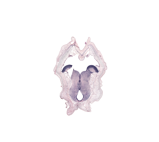 alar plate of metencephalon (cerebellum), artifact separation(s), caudal part of third ventricle, interpeduncular nucleus, oculomotor nerve tract, posterior commissure (diencephalon), red nucleus, rhombencoel (fourth ventricle), roof plate, tegmentum of mesencephalon, tegmentum of metencephalon