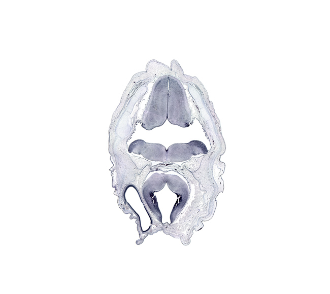 abducens nucleus, alar plate(s), artifact space(s), artifact(s), dural band for tentorium cerebelli, facial nerve tract, hypoglossal nucleus, lateral recess of rhombencoel (fourth ventricle), osteogenic layer, rectus capitis posterior major and minor muscles, semispinalis capitis muscle, splenius muscle, sulcus limitans, third ventricle, trapezius muscle