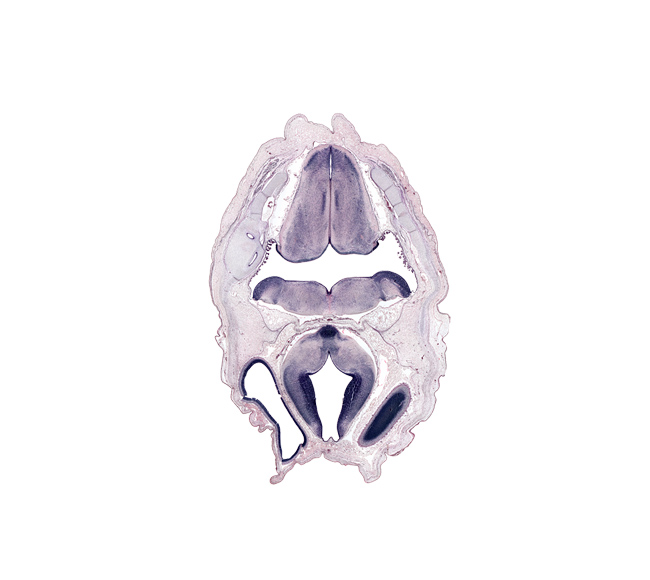 choroid plexus, dural limiting membrane, edge of cerebral vesicle (hemisphere), exoccipital, head mesenchyme, junction of diencephalon and mesencephalon, mamillary region, medial accessory olivary nucleus, median sulcus, oculomotor nerve (CN III), osteogenic layer, otic capsule, posterior cerebral artery, posterior dural venous plexus, roof plate of diencephalon, surface ectoderm, tractus solitarius nucleus