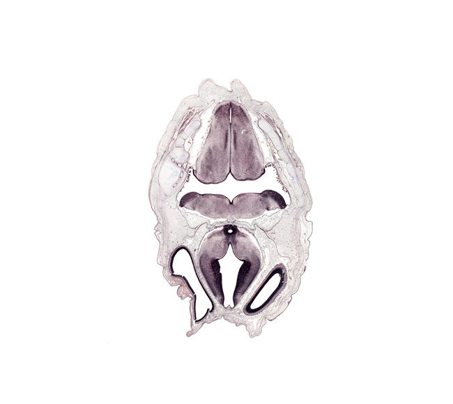 choroid plexus, diencephalon, fasciculus cuneatus, fasciculus gracilis, hypothalamic sulcus, mamillary recess, medial accessory olivary nucleus, median sulcus in floor of rhombencoel (fourth ventricle), myelencephalon (medulla oblongata), nucleus of spinal tract of trigeminal nerve, roof plate, spinal tract of trigeminal nerve (CN V), sulcus limitans, third ventricle, transverse dural sinus